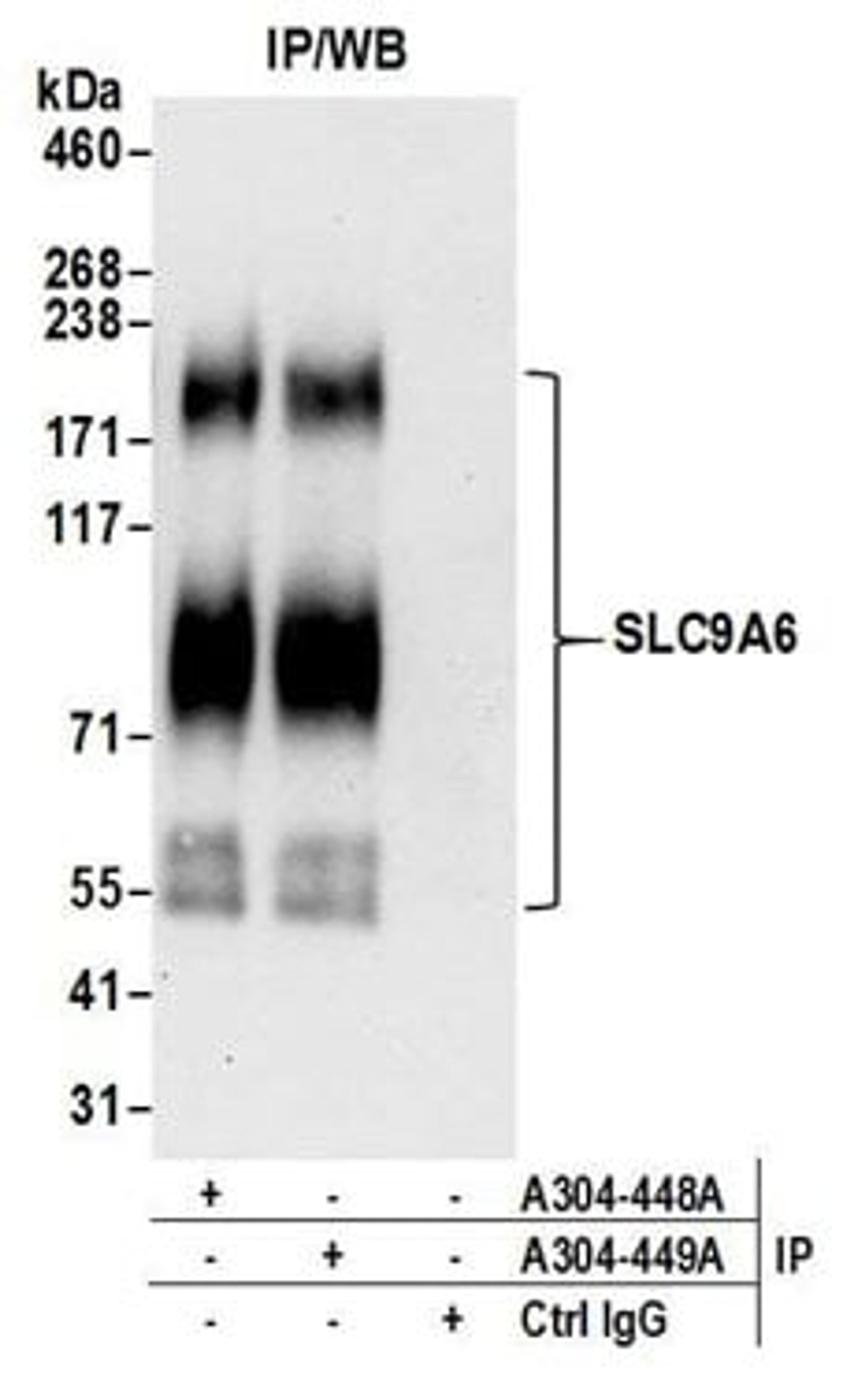 Detection of human SLC9A6 by western blot of immunoprecipitates.