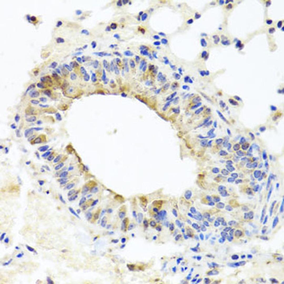 Immunohistochemistry  - MUC16 antibody (A10005)