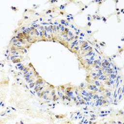 Immunohistochemistry - MUC16 antibody (A10005)