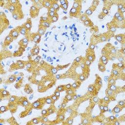 Immunohistochemistry - CCL25 antibody (A6543)