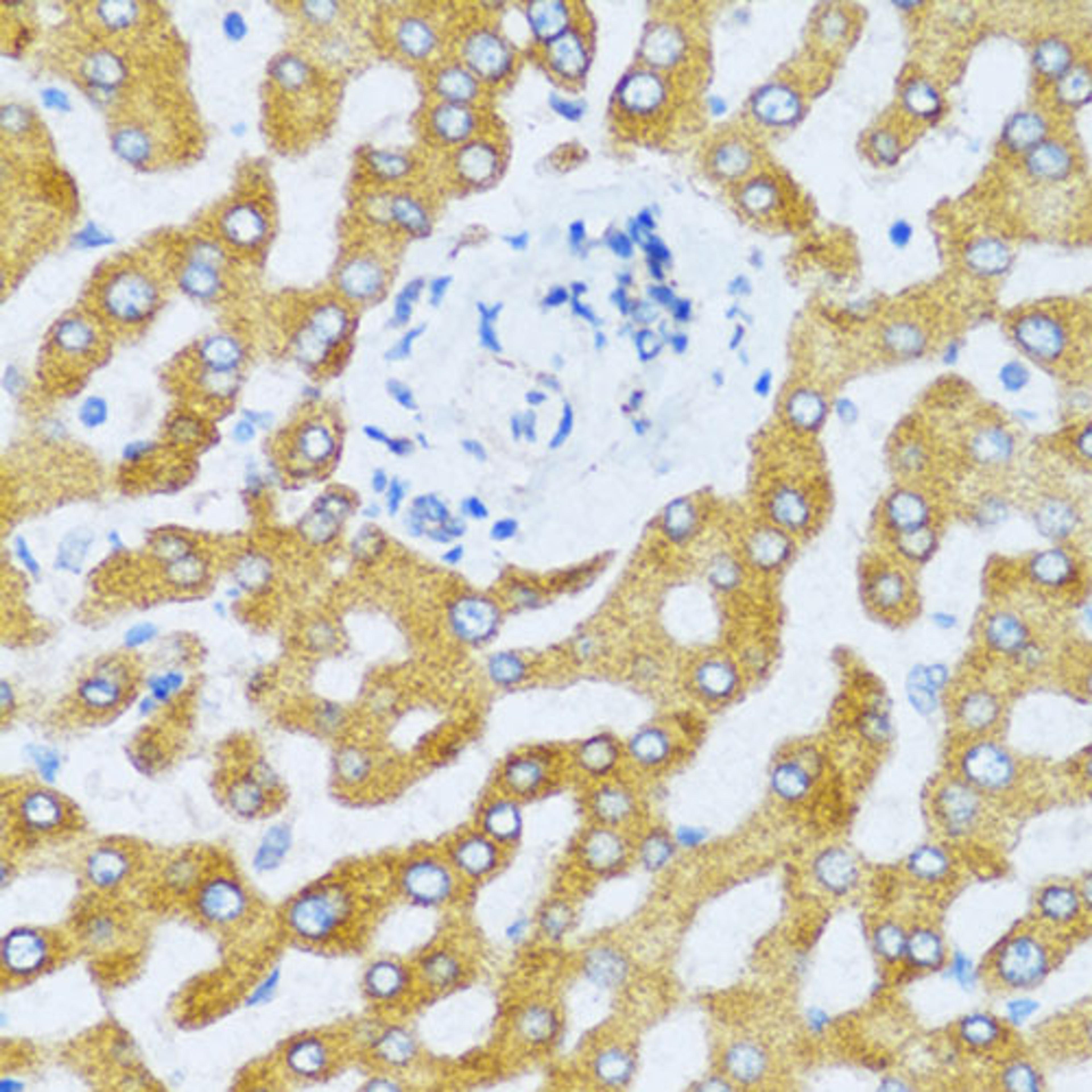 Immunohistochemistry - CCL25 antibody (A6543)