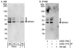 Detection of human SPHK1 by western blot and immunoprecipitation.