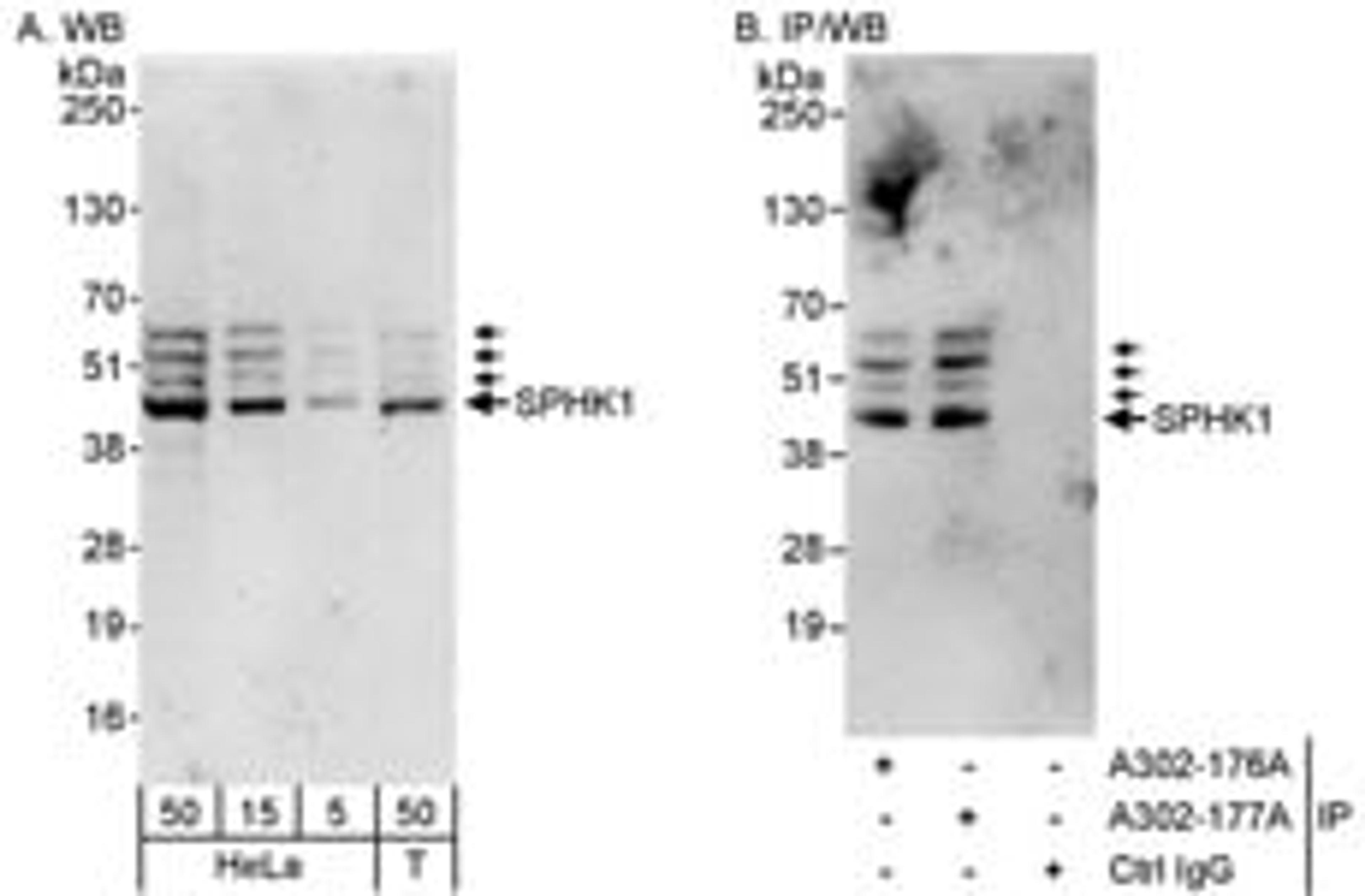 Detection of human SPHK1 by western blot and immunoprecipitation.