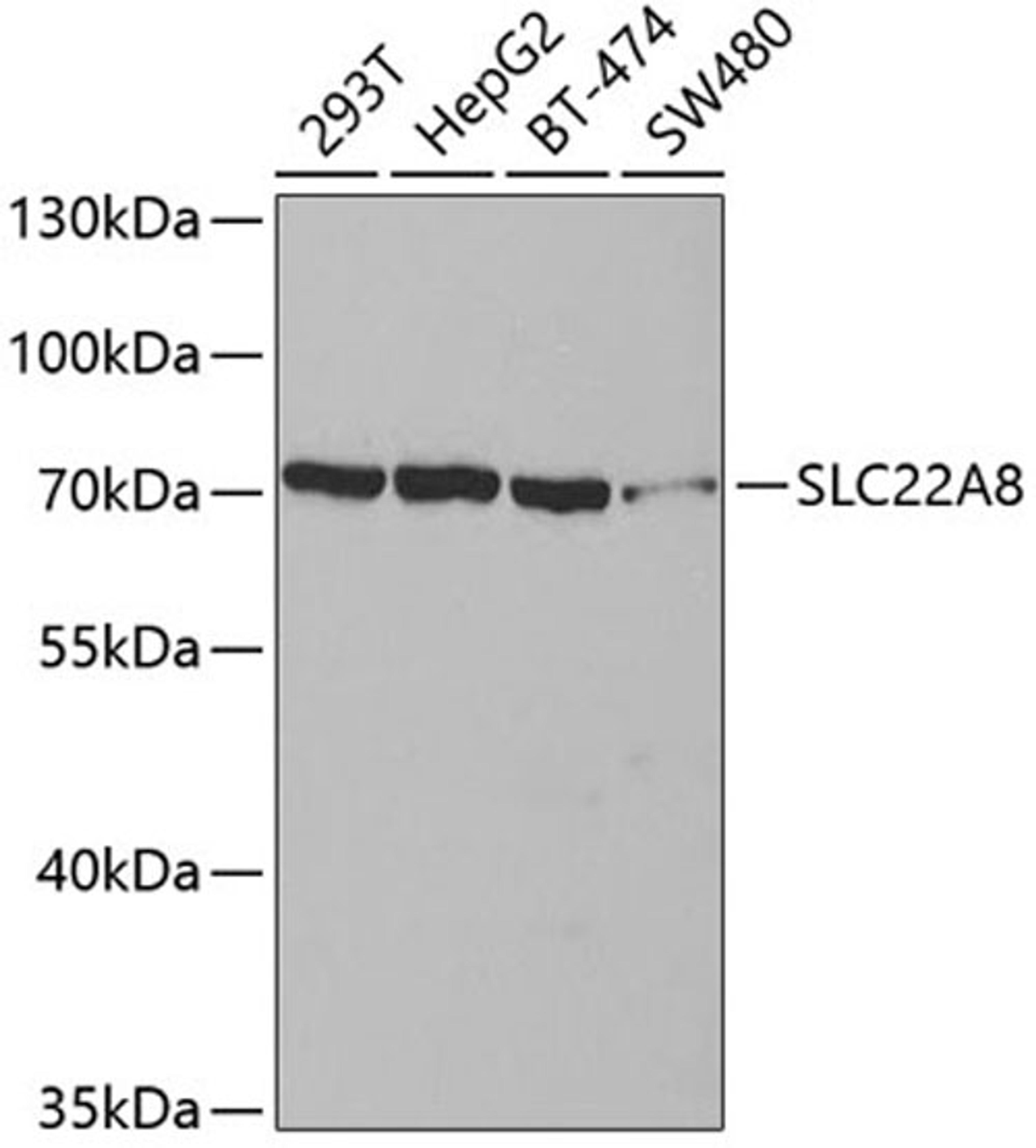 Western blot - SLC22A8 antibody (A3119)