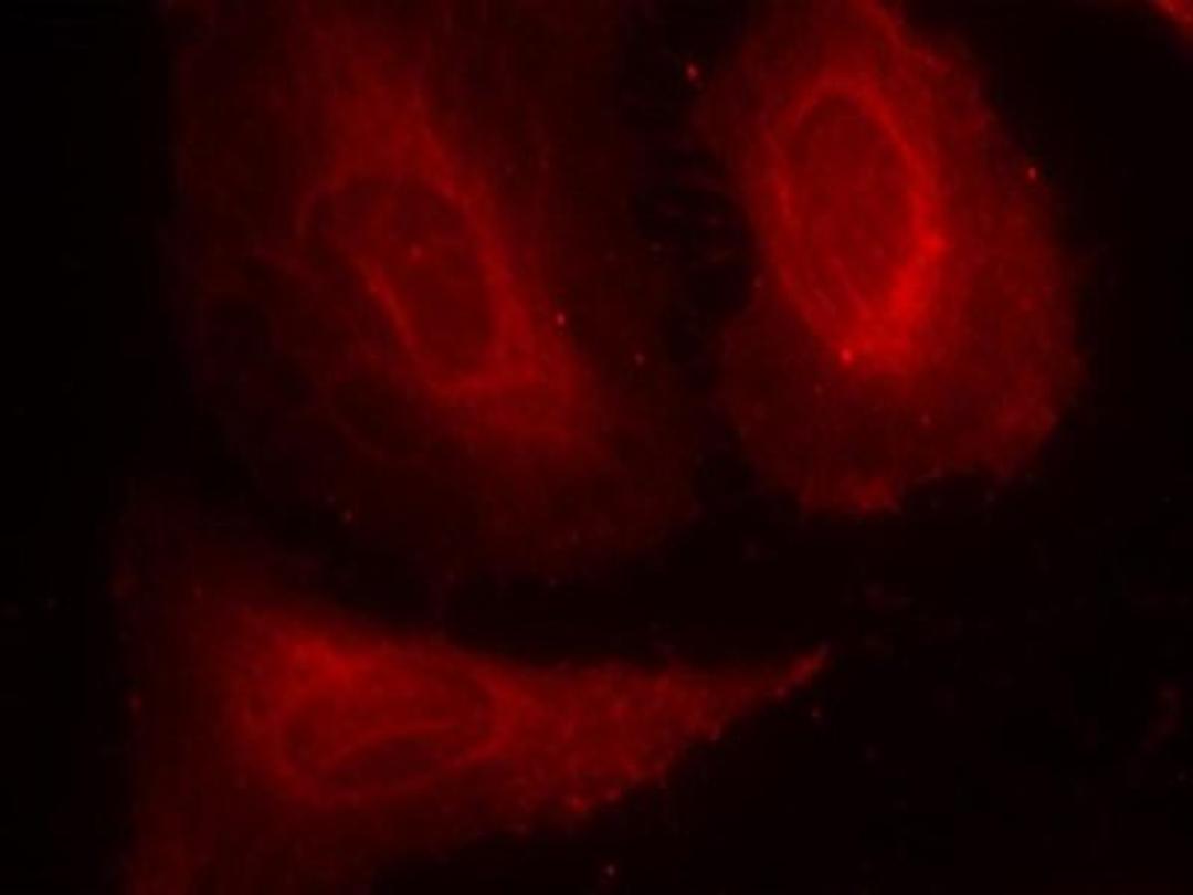 Immunocytochemistry/Immunofluorescence: PDK1 [p Ser241] Antibody [NB100-82137] - Staining of methanol-fixed Hela cells