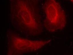 Immunocytochemistry/Immunofluorescence: PDK1 [p Ser241] Antibody [NB100-82137] - Staining of methanol-fixed Hela cells