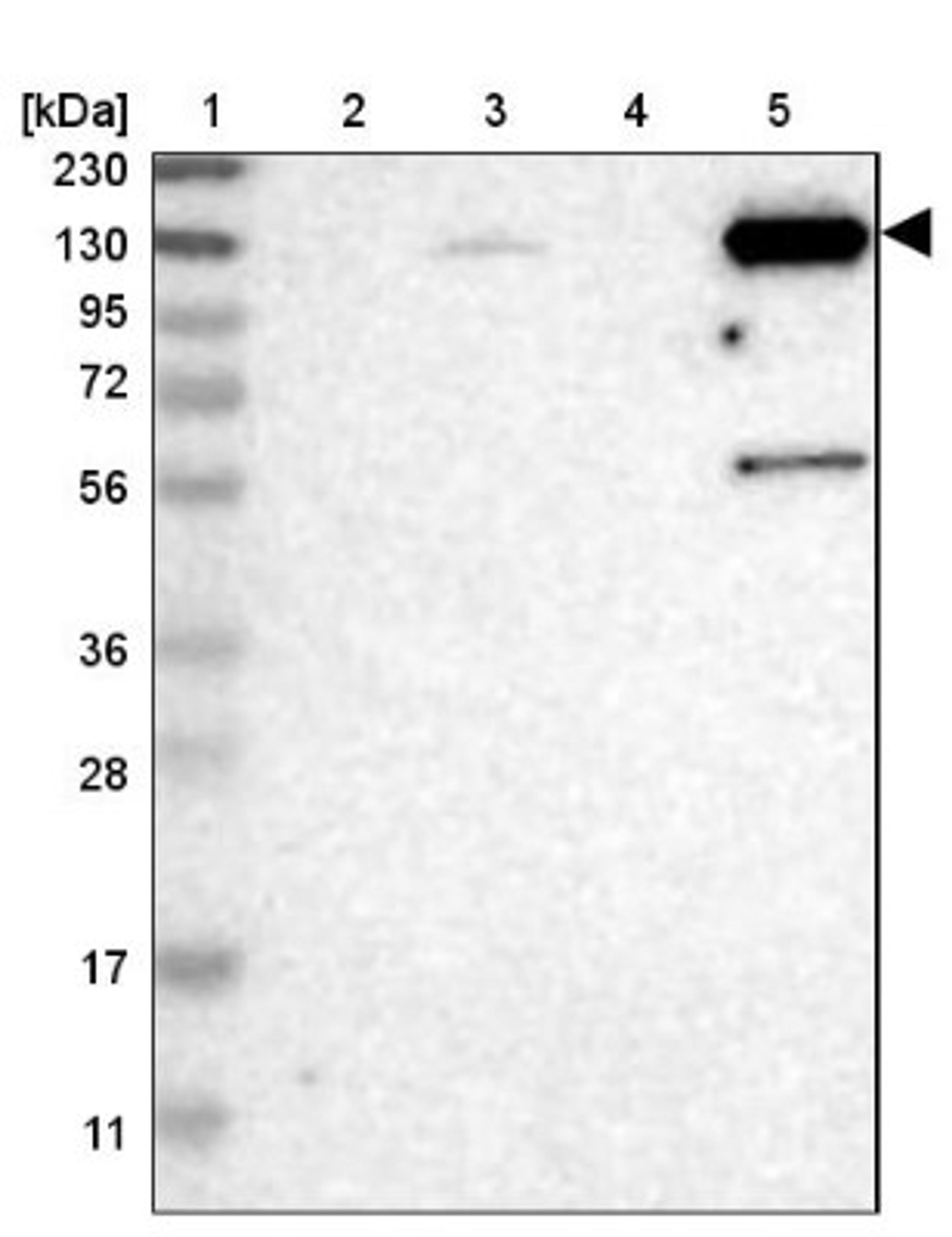 Western Blot: ZNF629 Antibody [NBP1-93643] - Lane 1: Marker [kDa] 230, 130, 95, 72, 56, 36, 28, 17, 11<br/>Lane 2: Human cell line RT-4<br/>Lane 3: Human cell line U-251MG sp<br/>Lane 4: Human plasma (IgG/HSA depleted)<br/>Lane 5: Human liver tissue