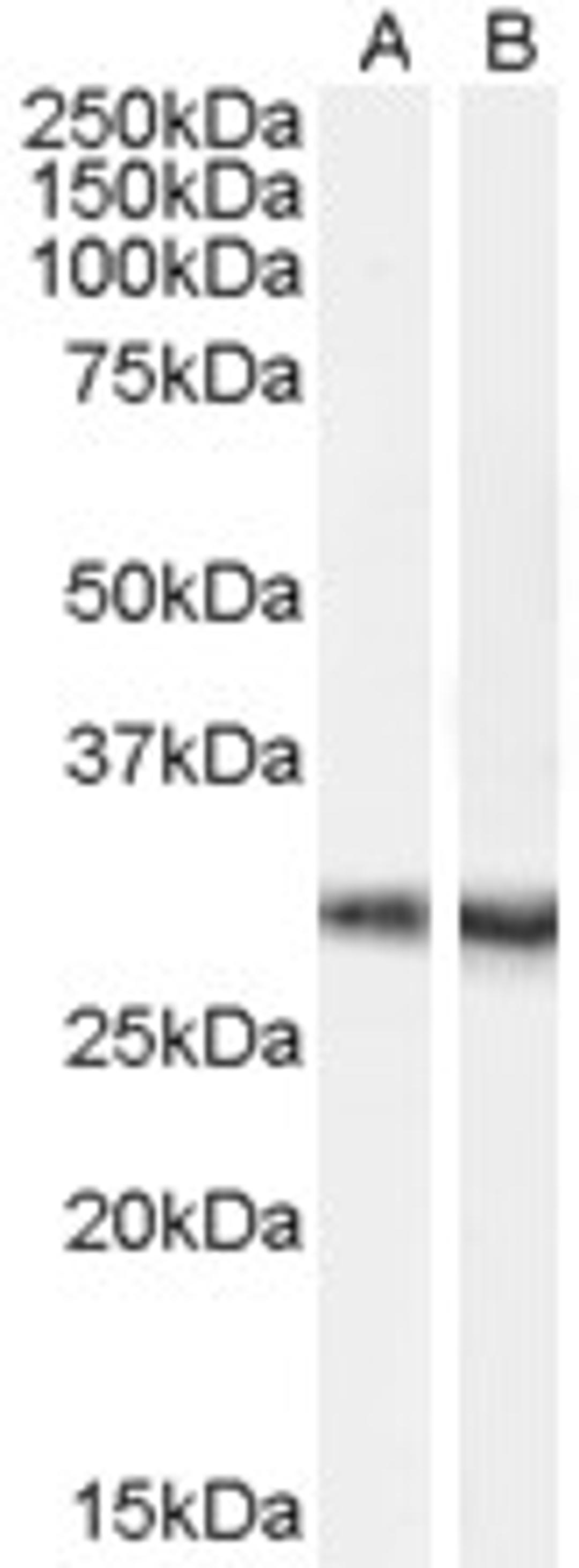 Staining of mouse brain lysate (35ug protein in RIPA buffer) with A) 45-465 (0.1ug/ml) and B) 45-464. Primary incubation was 1 hour. Detected by chemiluminescence.