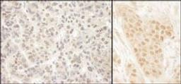 Detection of human MCAK by immunohistochemistry.