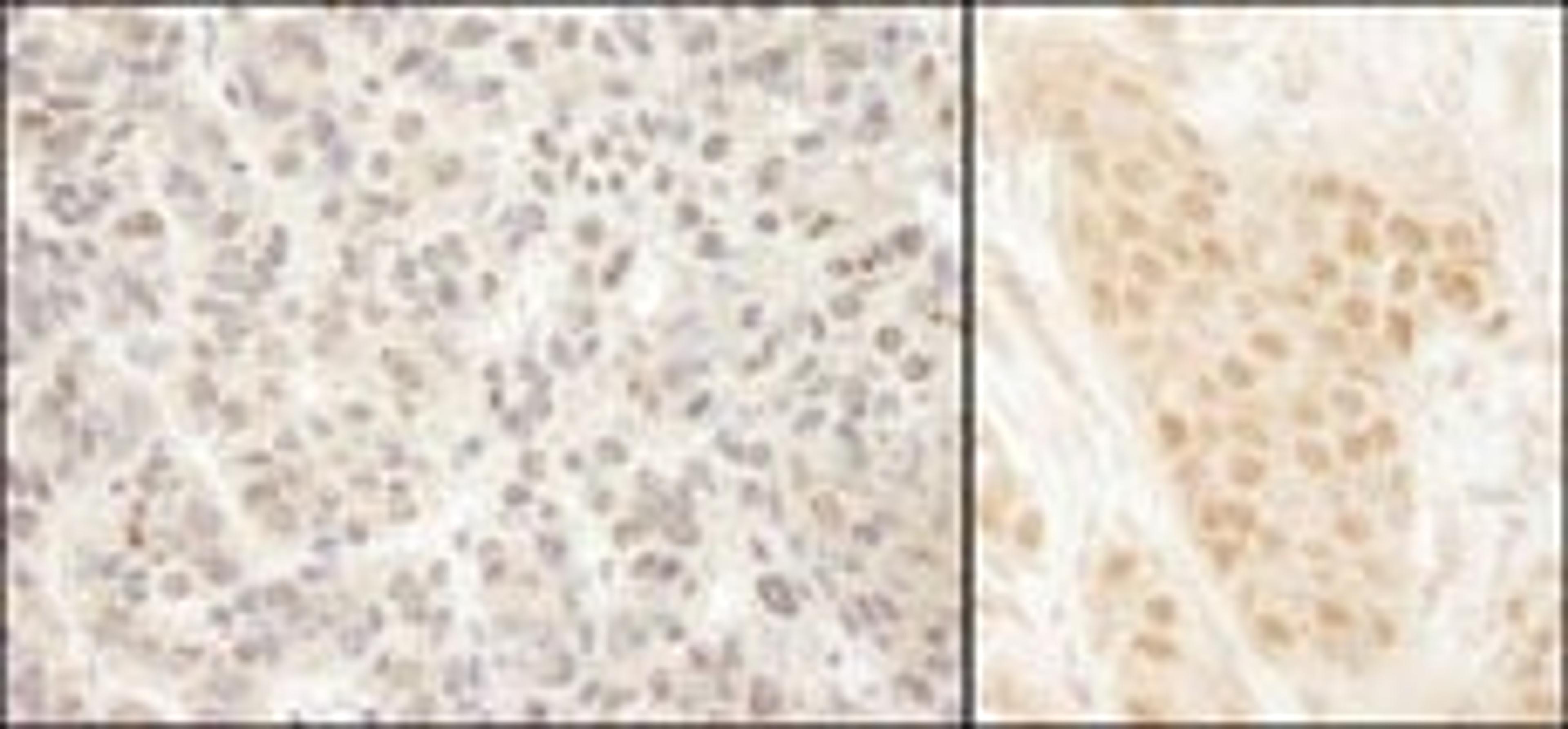 Detection of human MCAK by immunohistochemistry.