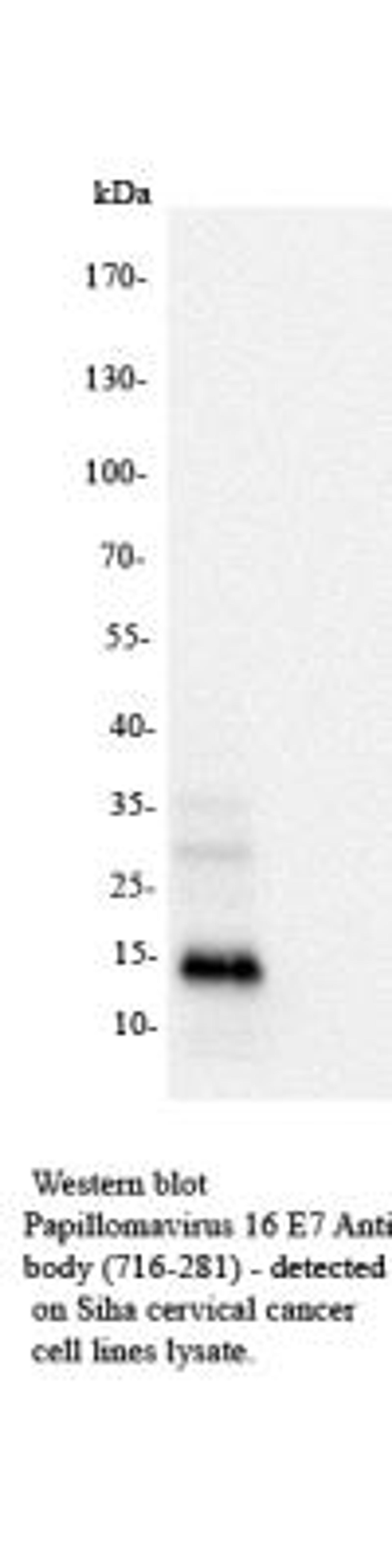 Western Blot: Papillomavirus 16 E7 Antibody (716-281) [NB110-17178] - Papillomavirus 16 E7 in SiHa whole cell lysate. Image from verified customer review.