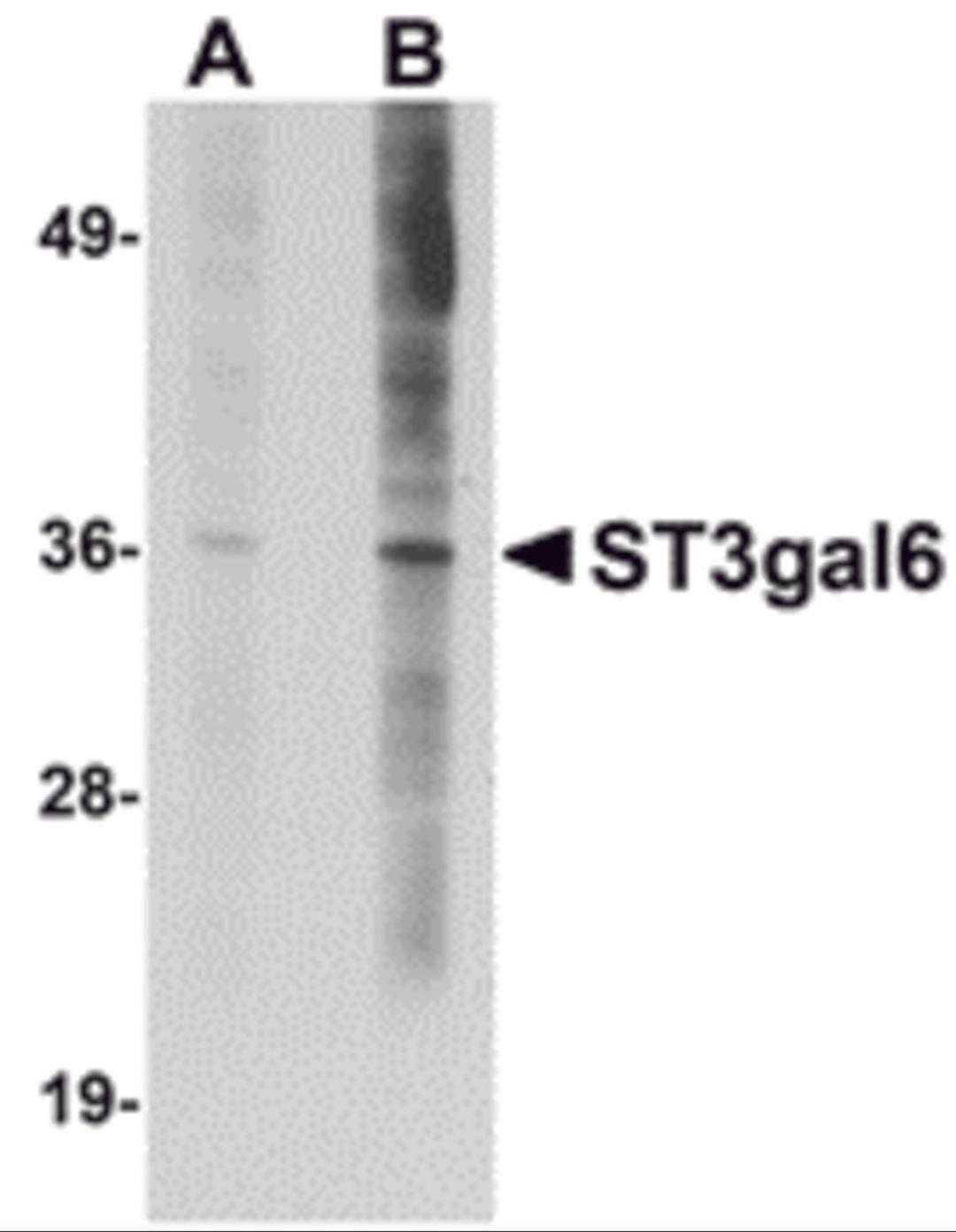 Western blot analysis of ST3gal6 in HeLa cell lysate with ST3gal6 antibody at (A) 1 and (B) 2 &#956;g/mL.