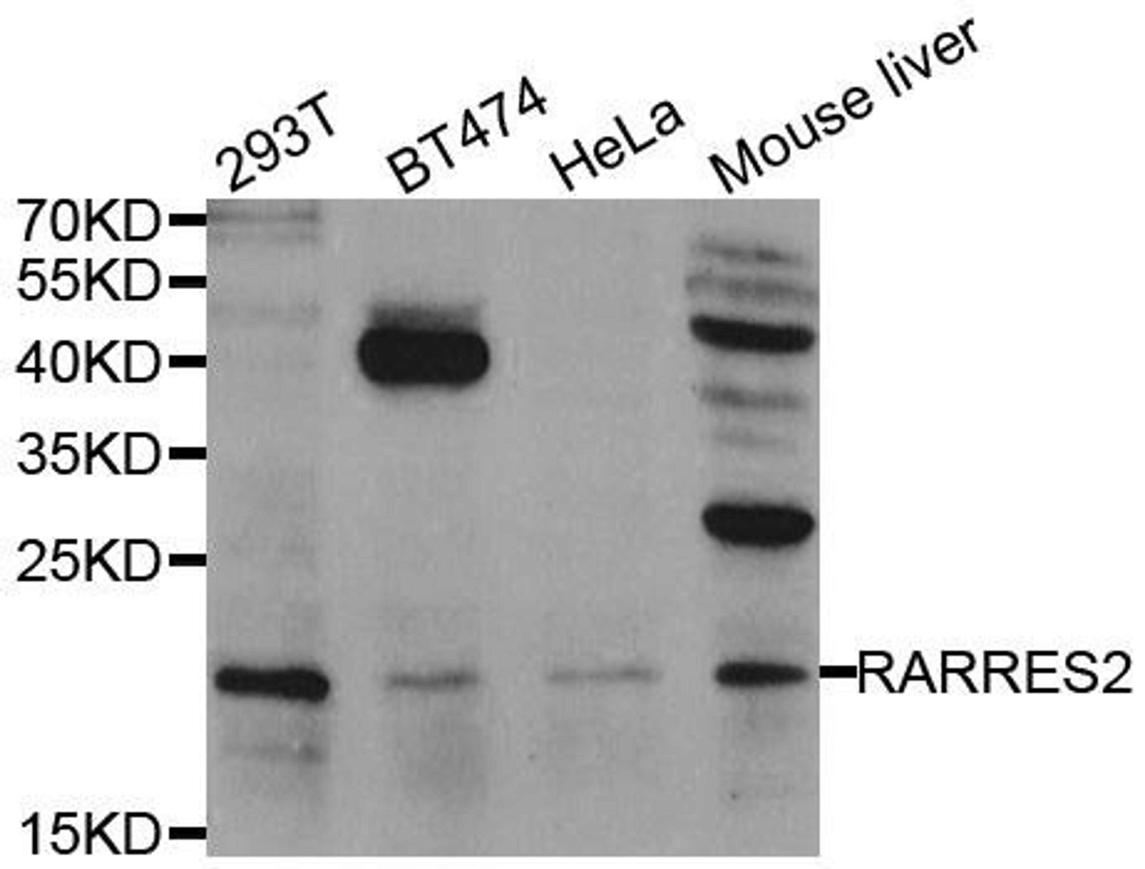 Western blot analysis of extracts of various cell lines using RARRES2 antibody