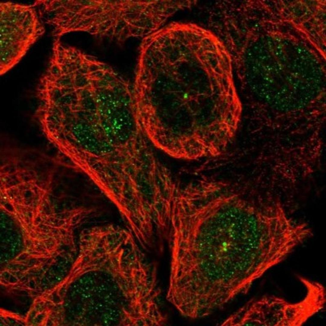 Immunocytochemistry/Immunofluorescence: C1orf51 Antibody [NBP1-88685] - Staining of human cell line A-431 shows positivity in nucleus & centrosome.