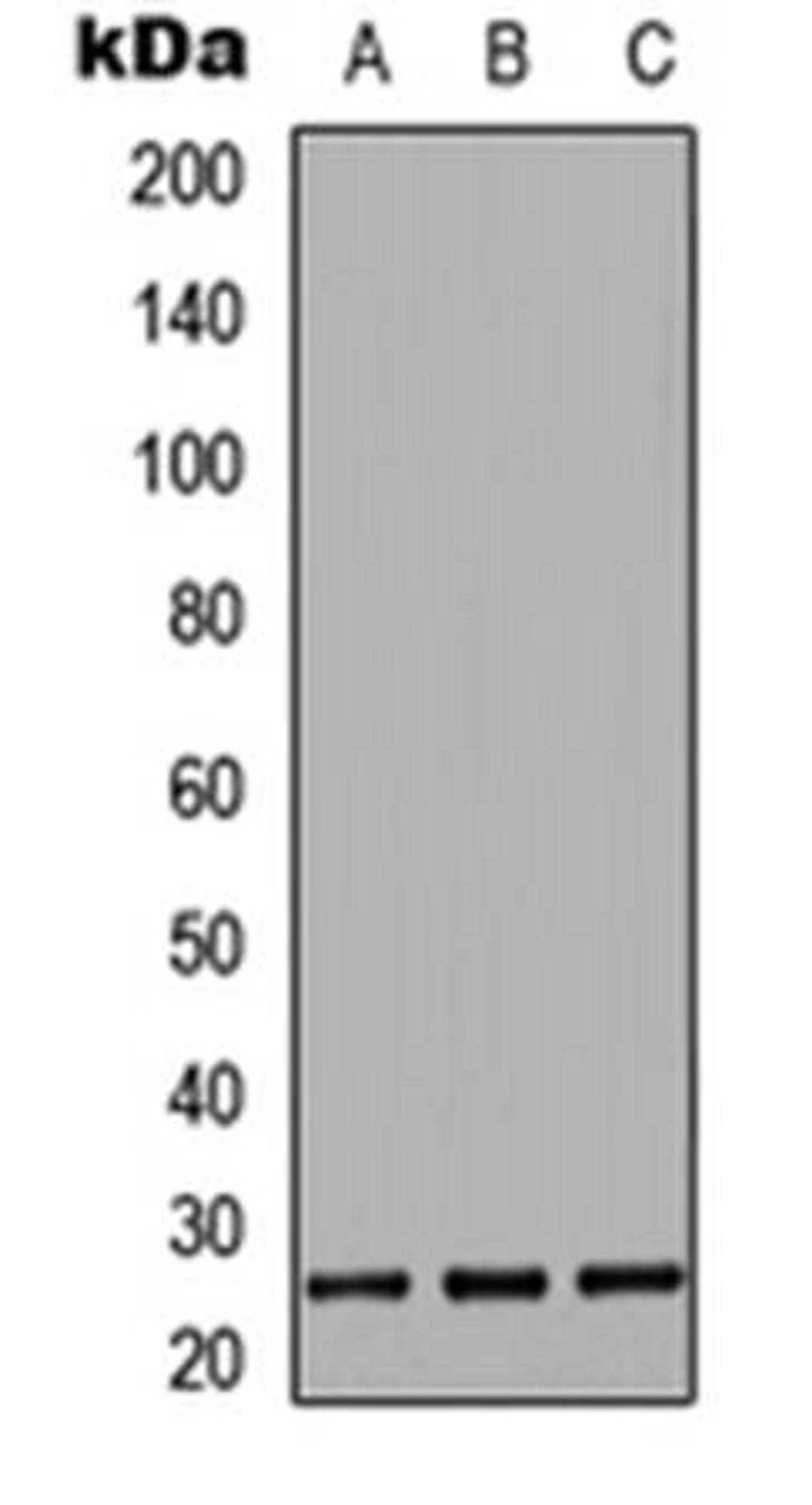 Western blot analysis of HeLa (Lane1), Raw264.7 (Lane2), PC12 (Lane3) whole cell using IL-27B antibody