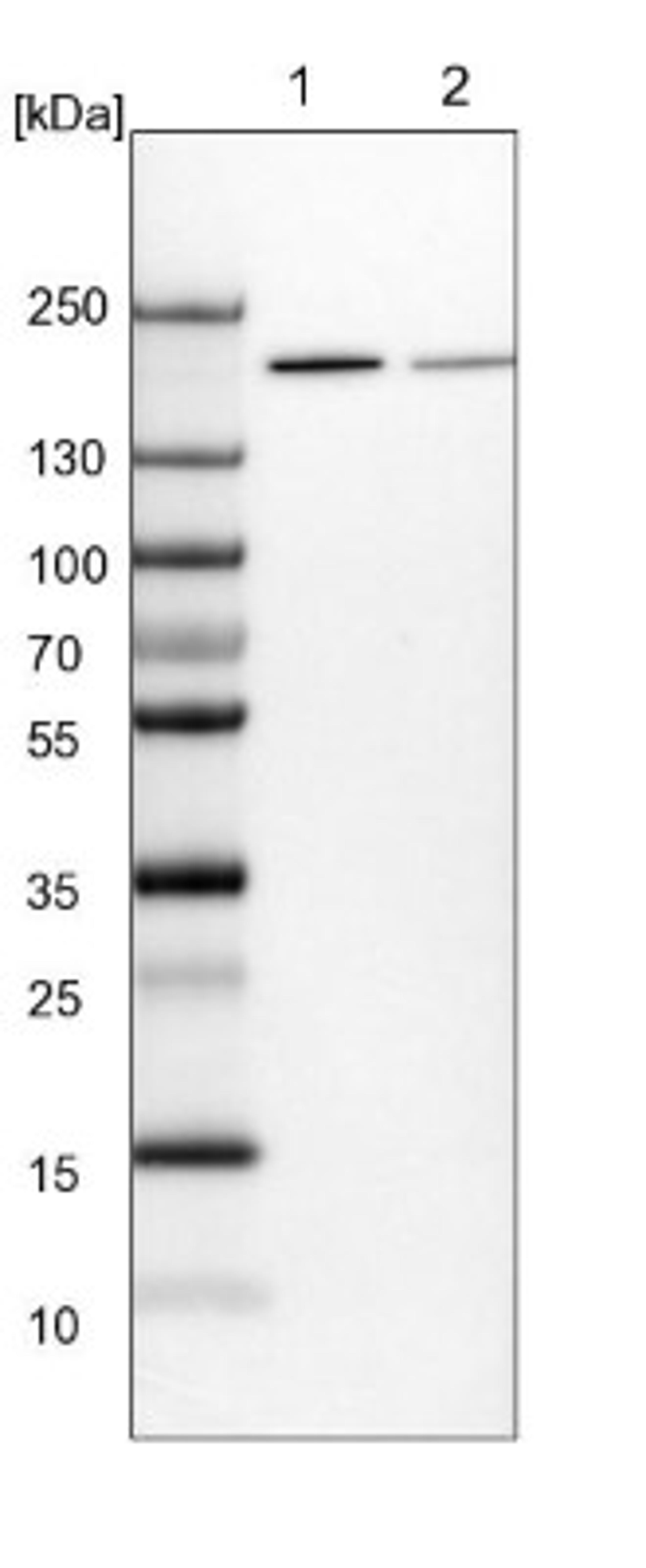 Western Blot: UGGT1 Antibody [NBP1-81651] - Lane 1: NIH-3T3 cell lysate (Mouse embryonic fibroblast cells)<br/>Lane 2: NBT-II cell lysate (Rat Wistar bladder tumour cells)