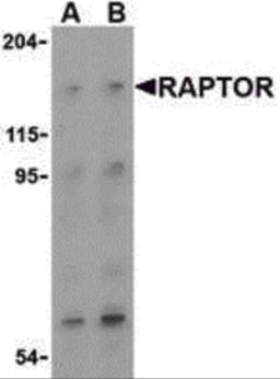 Western blot analysis of Raptor in L1210 cell lysate with Raptor (IN) antibody at (A) 2 and (B) 4 &#956;g/mL.