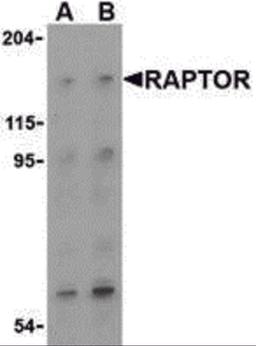 Western blot analysis of Raptor in L1210 cell lysate with Raptor (IN) antibody at (A) 2 and (B) 4 μg/mL.