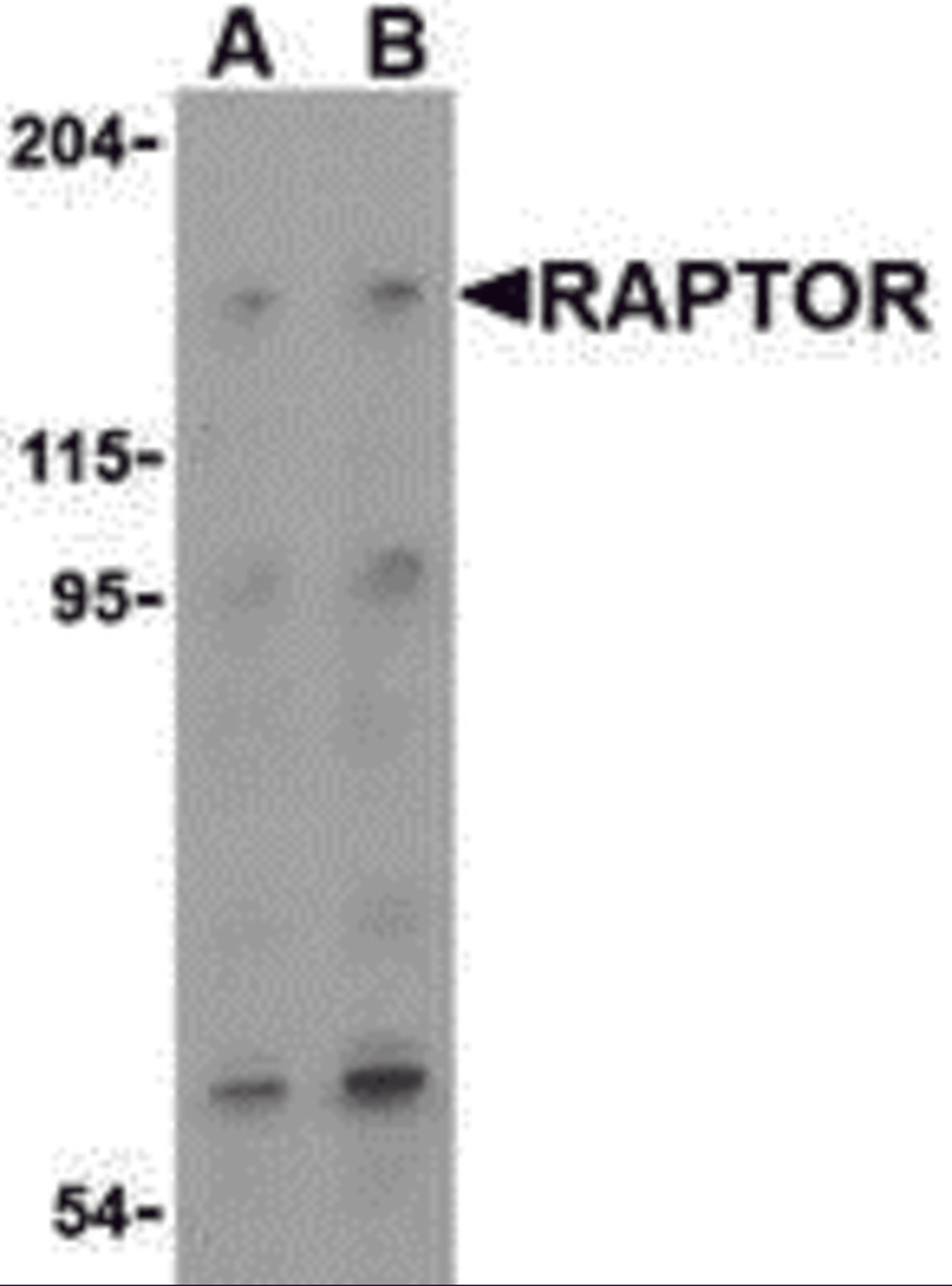 Western blot analysis of Raptor in L1210 cell lysate with Raptor (IN) antibody at (A) 2 and (B) 4 μg/mL.