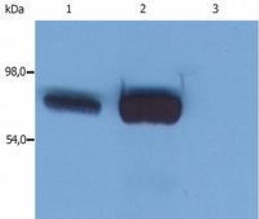 Western Blot: SLP-76/LCP2 Antibody (SLP-76/03) [NB500-537] - Lane 1: HPB-ALL human peripheral blood T cell leukemia cell line  Lane 2: JURKAT human peripheral blood T cell leukemia cell line  Lane 3: RAMOS human Burkitt lymphoma cell line