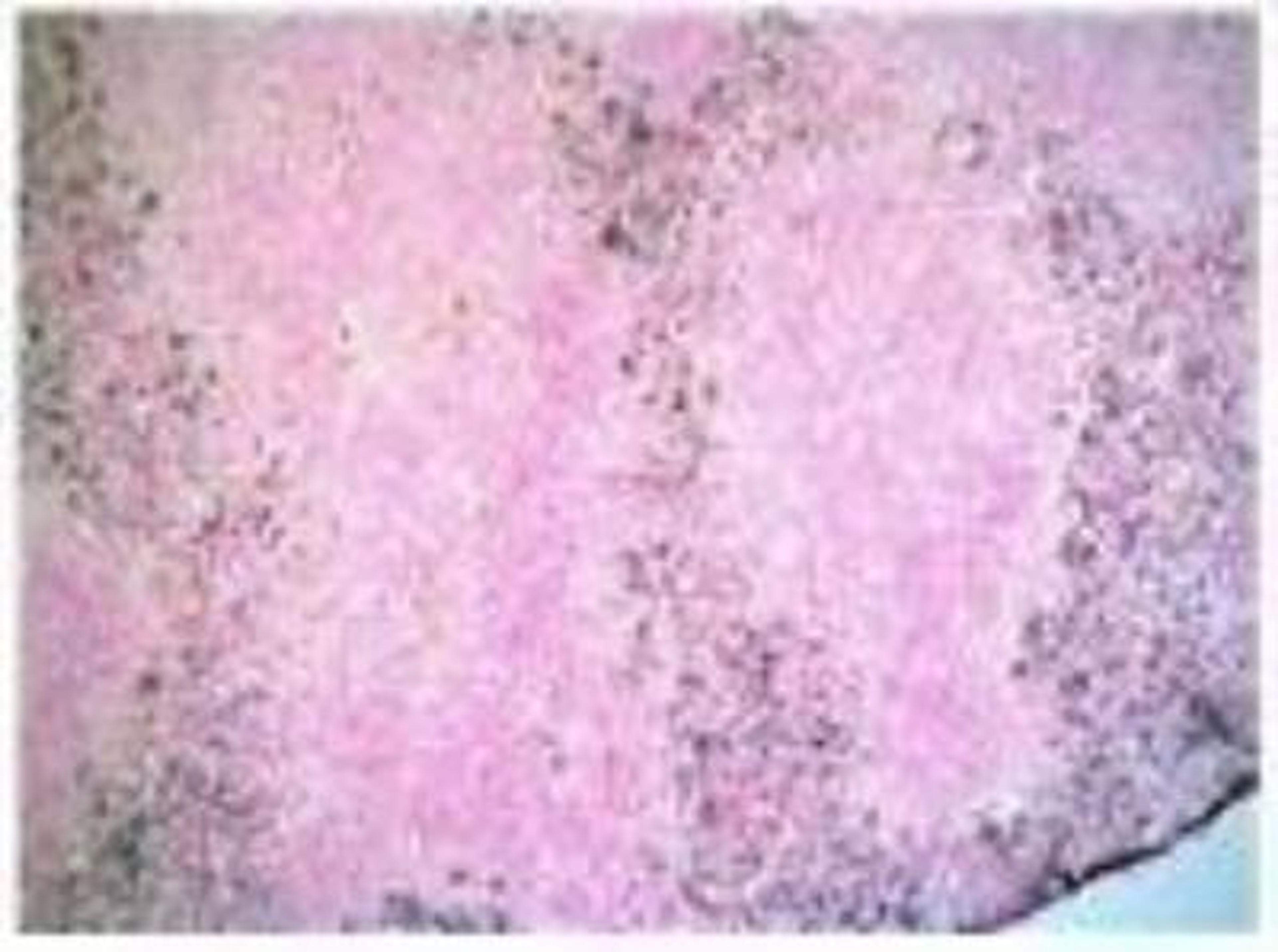 Immunohistochemistry-Frozen: Ly-6G6C Antibody (NIMP-R14) [NB600-1387] - Staining for Ly-6G/-6C FITC of frozen section of mouse spleen.