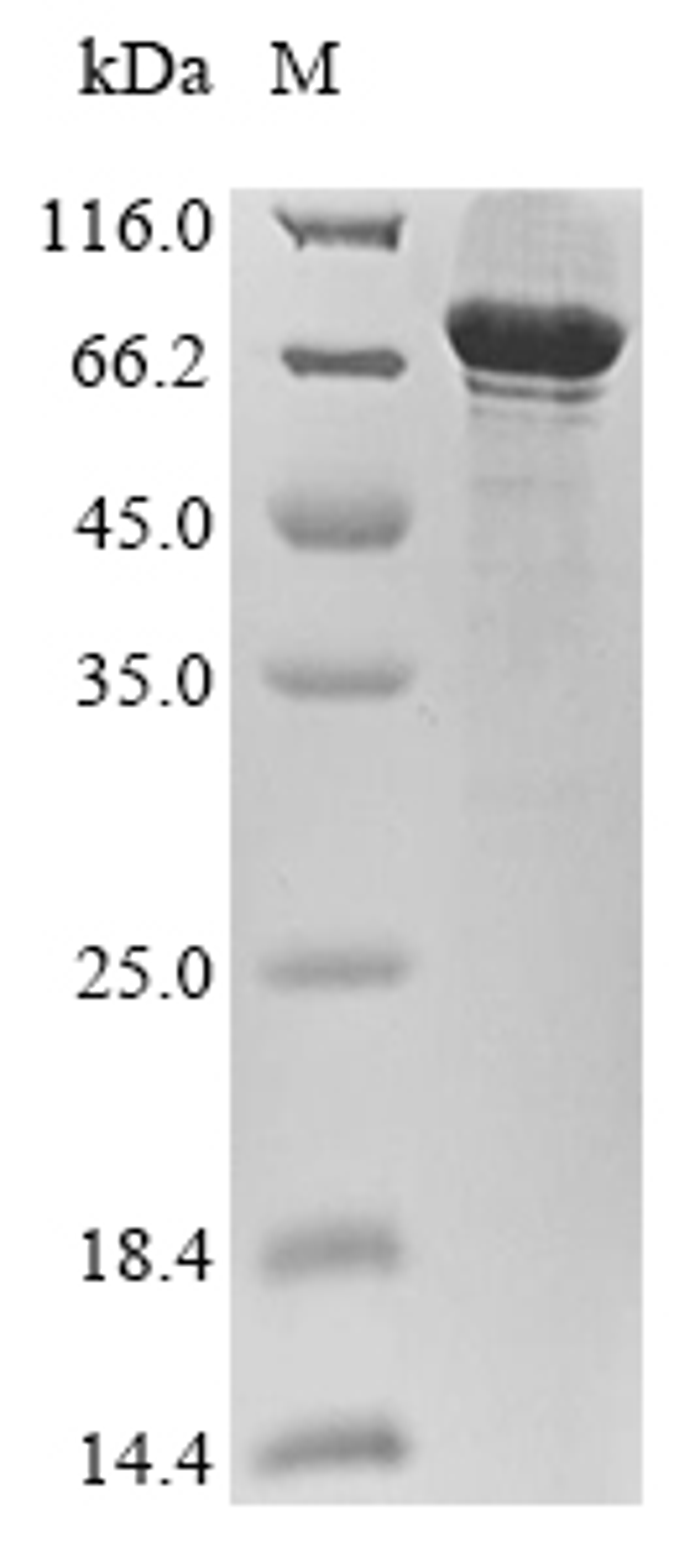 (Tris-Glycine gel) Discontinuous SDS-PAGE (reduced) with 5% enrichment gel and 15% separation gel.
