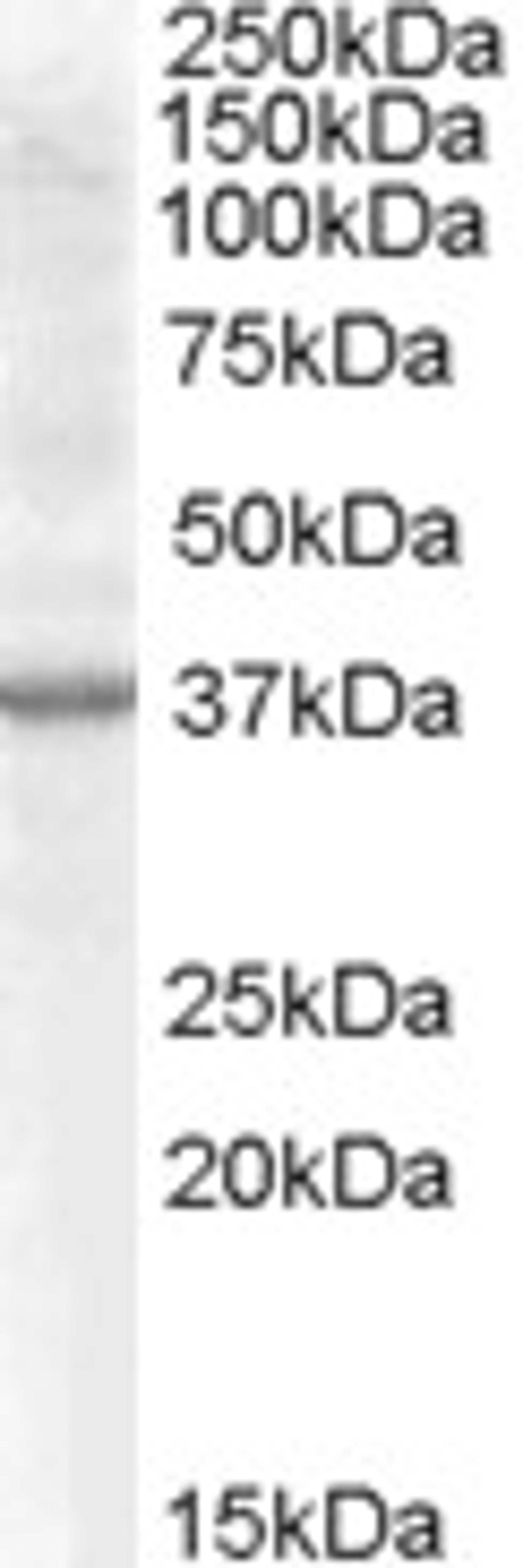 46-279 (0.5ug/ml) staining of Rat Kidney lysate (35ug protein in RIPA buffer). Primary incubation was 1 hour. Detected by chemiluminescence.