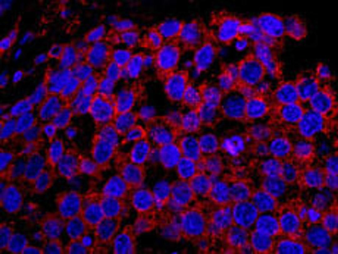 Detection of human EPS15 by IHC-IF.