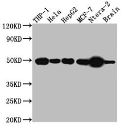 Western Blot. Positive WB detected in: THP-1 whole cell lysate, Hela whole cell lysate, HepG2 whole cell lysate, MCF-7 whole cell lysate, Ntera-2 whole cell lysate, Mouse Brain whole cell lysate. All lanes: TACR1 antibody at 1:1000. Secondary. Goat polyclonal to rabbit IgG at 1/50000 dilution. Predicted band size: 47, 36 kDa. Observed band size: 50 kDa.