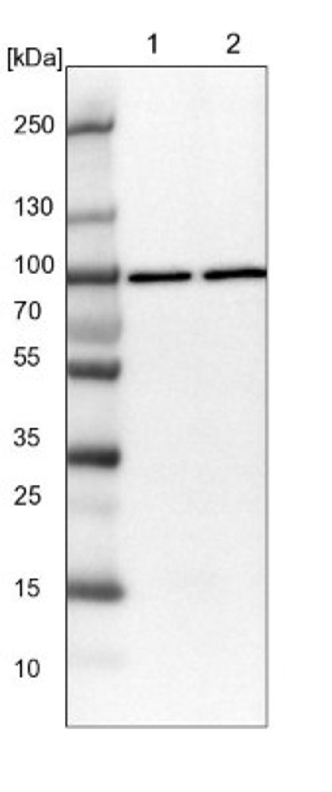 Western Blot: QARS Antibody [NBP1-89487] - Lane 1: NIH-3T3 cell lysate (Mouse embryonic fibroblast cells)<br/>Lane 2: NBT-II cell lysate (Rat Wistar bladder tumour cells)