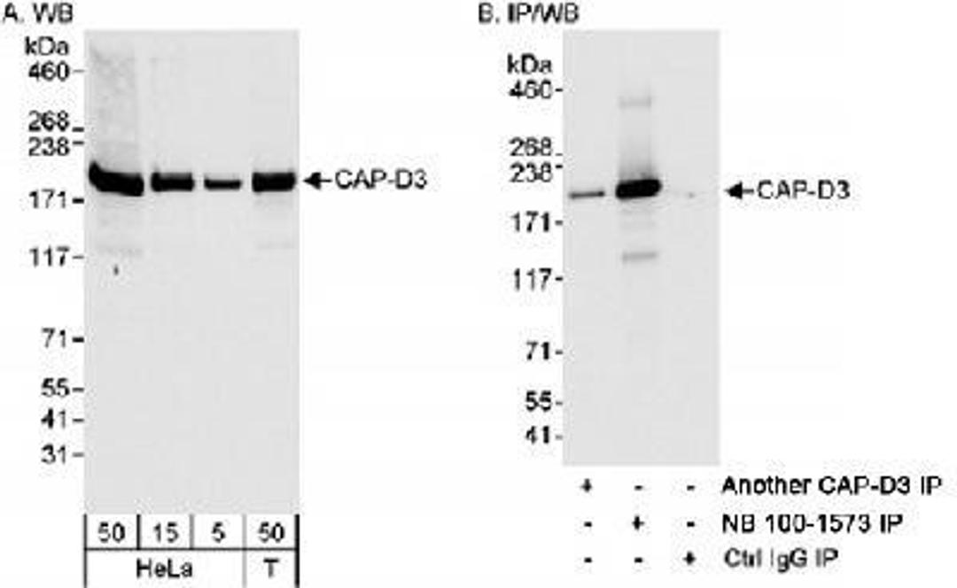 Western Blot: NCAPD3 Antibody [NB100-1573] - Detection of Human CAP-D3 on HeLa whole cell lysate using NB100-1573.