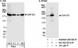 Western Blot: NCAPD3 Antibody [NB100-1573] - Detection of Human CAP-D3 on HeLa whole cell lysate using NB100-1573.