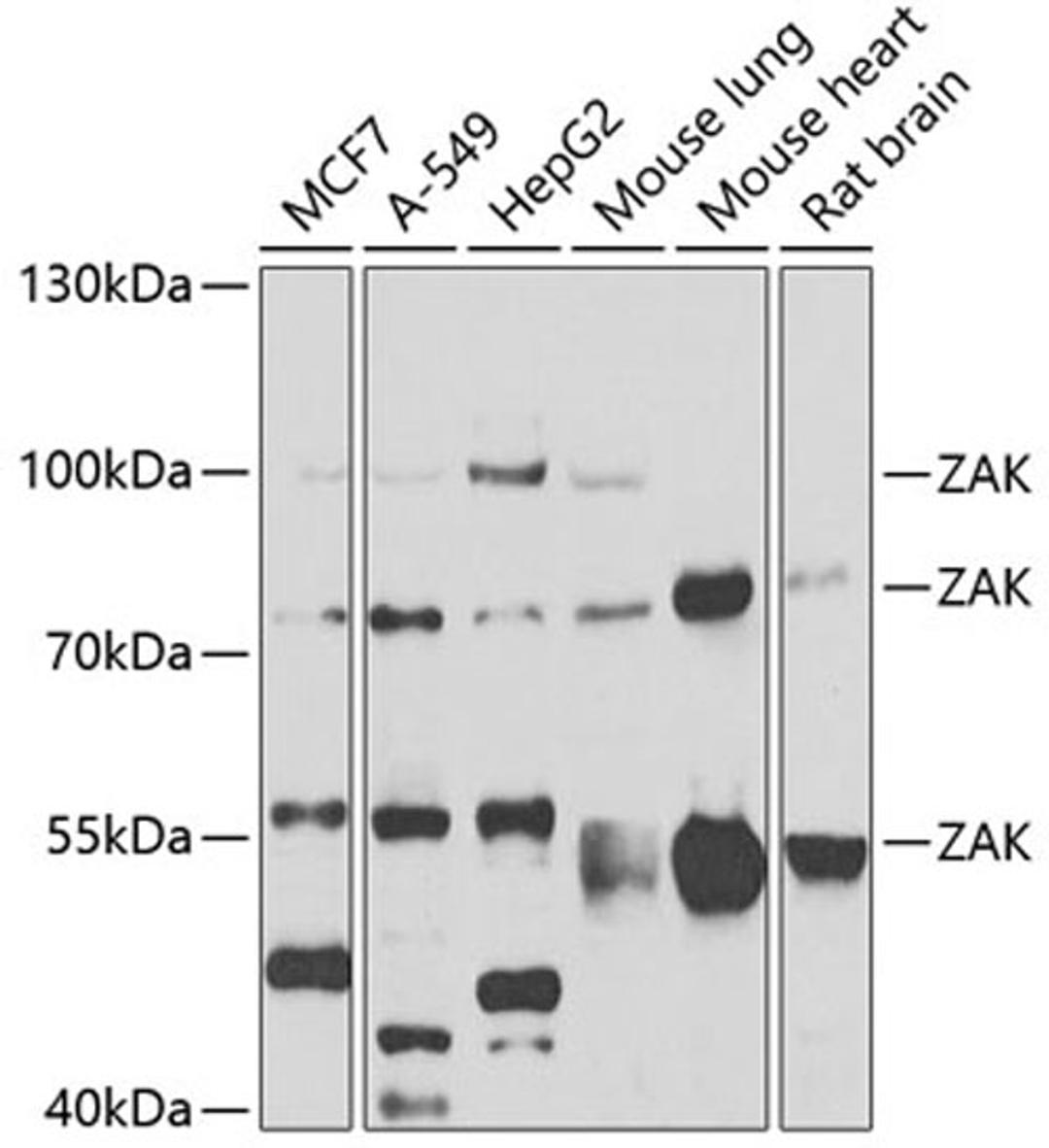 Western blot - ZAK antibody (A7371)