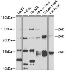 Western blot - ZAK antibody (A7371)