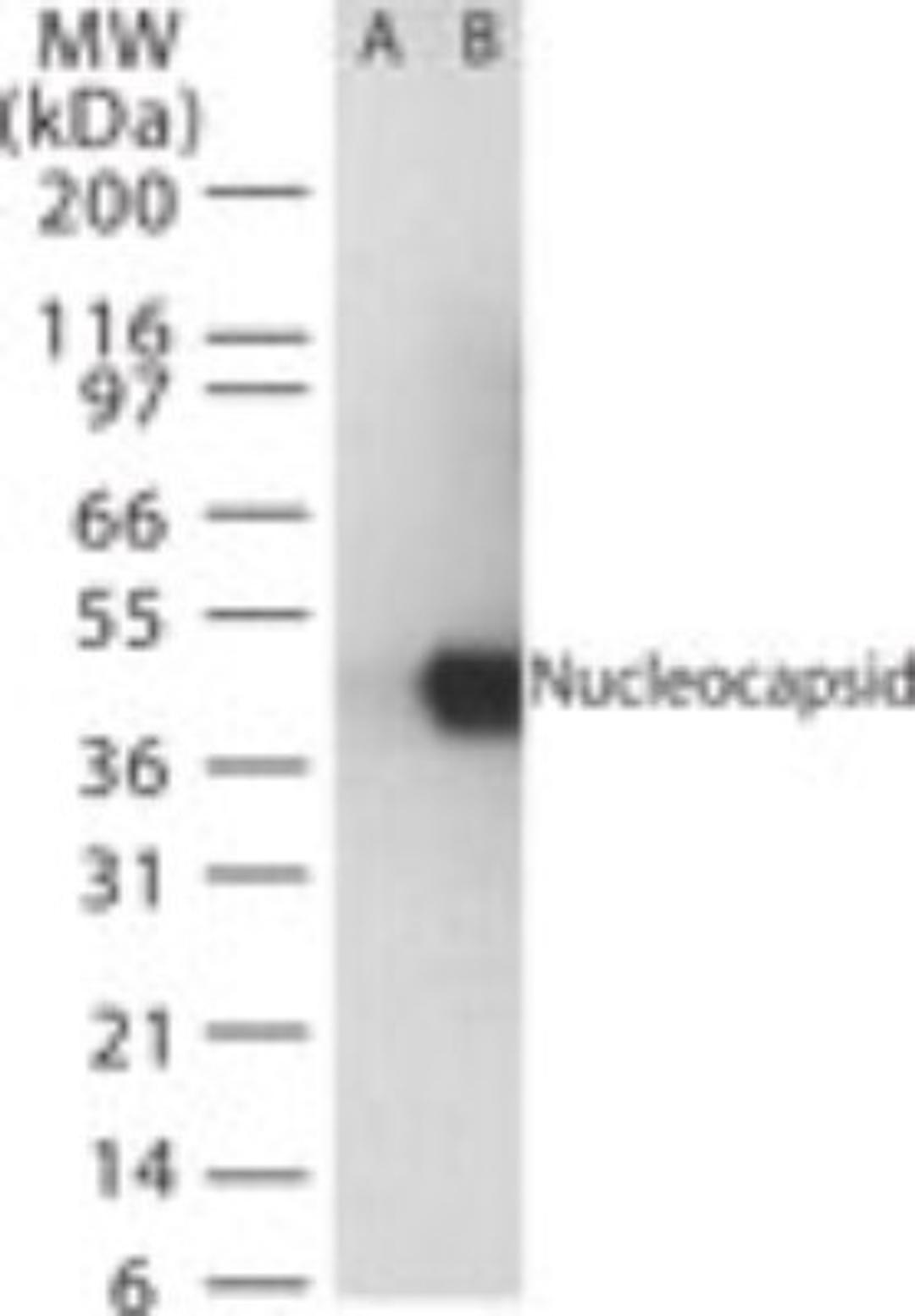 Western Blot: SARS Nucleocapsid Protein Antibody [NB100-56576] - analysis of SARS Nucleocapsid in (A) untransfected mouse melanoma cell lysate and (B) transfected cell lysate using this antibody.