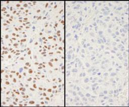 Detection of mouse Phospho XRCC1 (S518/T519/T523) by immunohistochemistry.