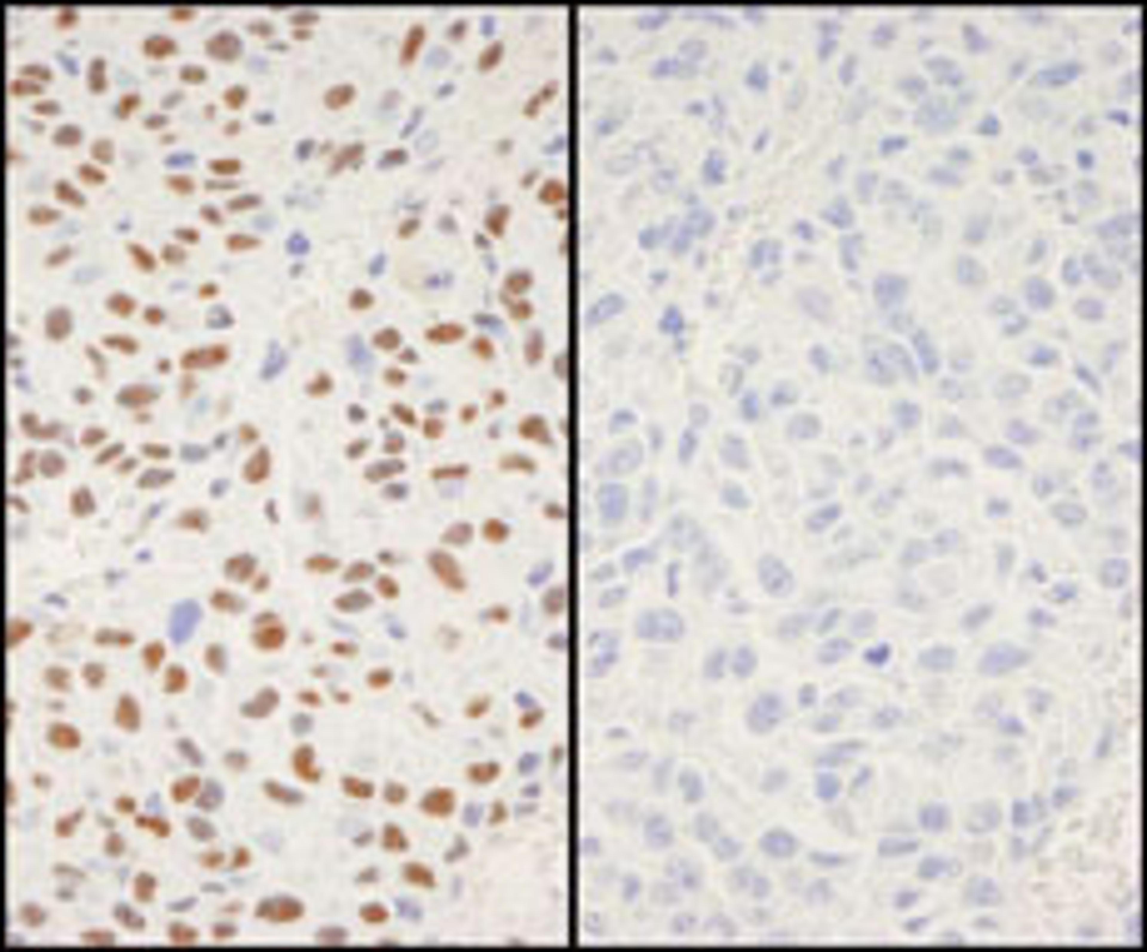 Detection of mouse Phospho XRCC1 (S518/T519/T523) by immunohistochemistry.