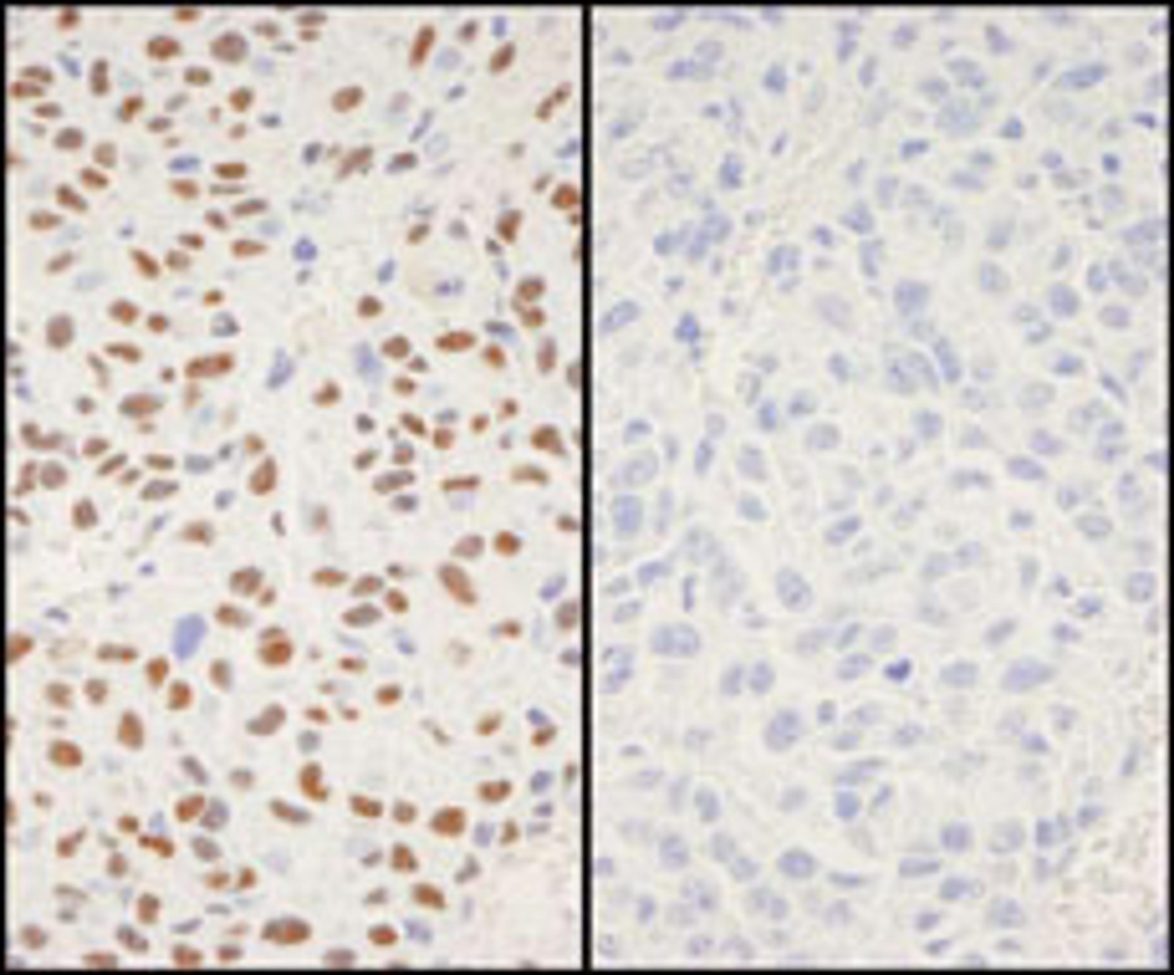 Detection of mouse Phospho XRCC1 (S518/T519/T523) by immunohistochemistry.