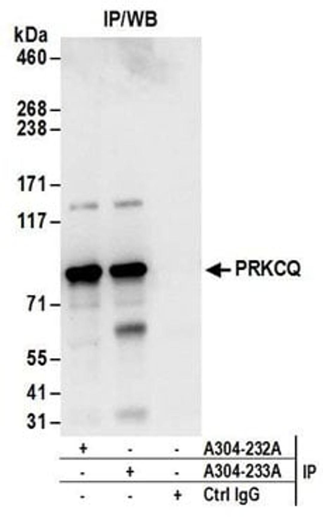 Detection of human PRKCQ by western blot of immunoprecipitates.