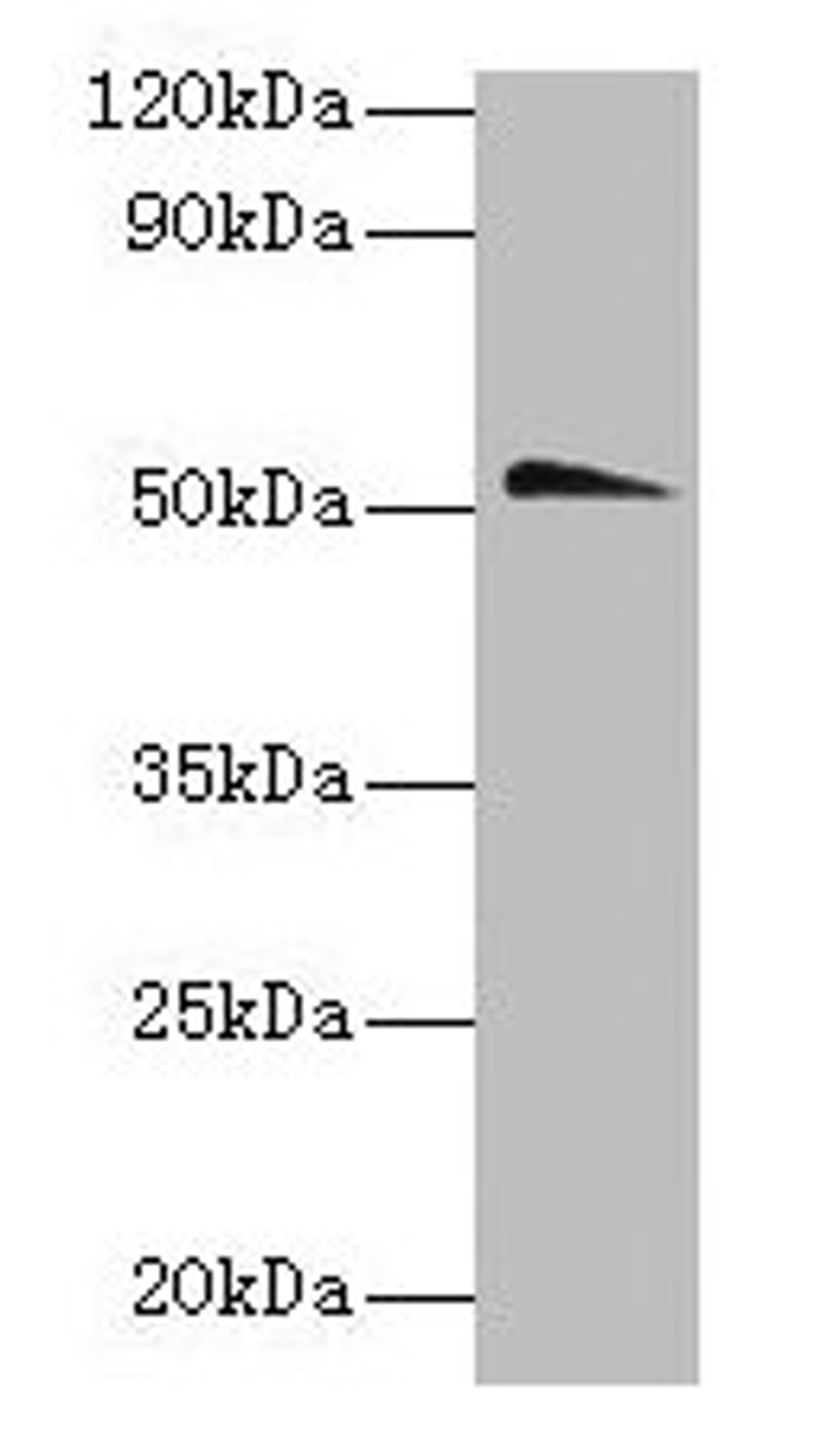 Western blot. All lanes: Chrna1 antibody at 2µg/ml + Hela whole lysate. Secondary. Goat polyclonal to rabbit IgG at 1/10000 dilution. Predicted band size: 52 kDa. Observed band size: 52 kDa
