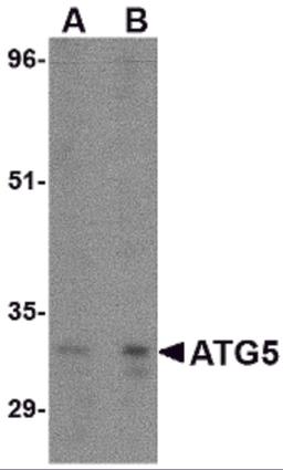 Western blot analysis of ATG5 in rat spleen tissue lysate with ATG5 antibody at (A) 1 and (B) 2 &#956;g/mL.