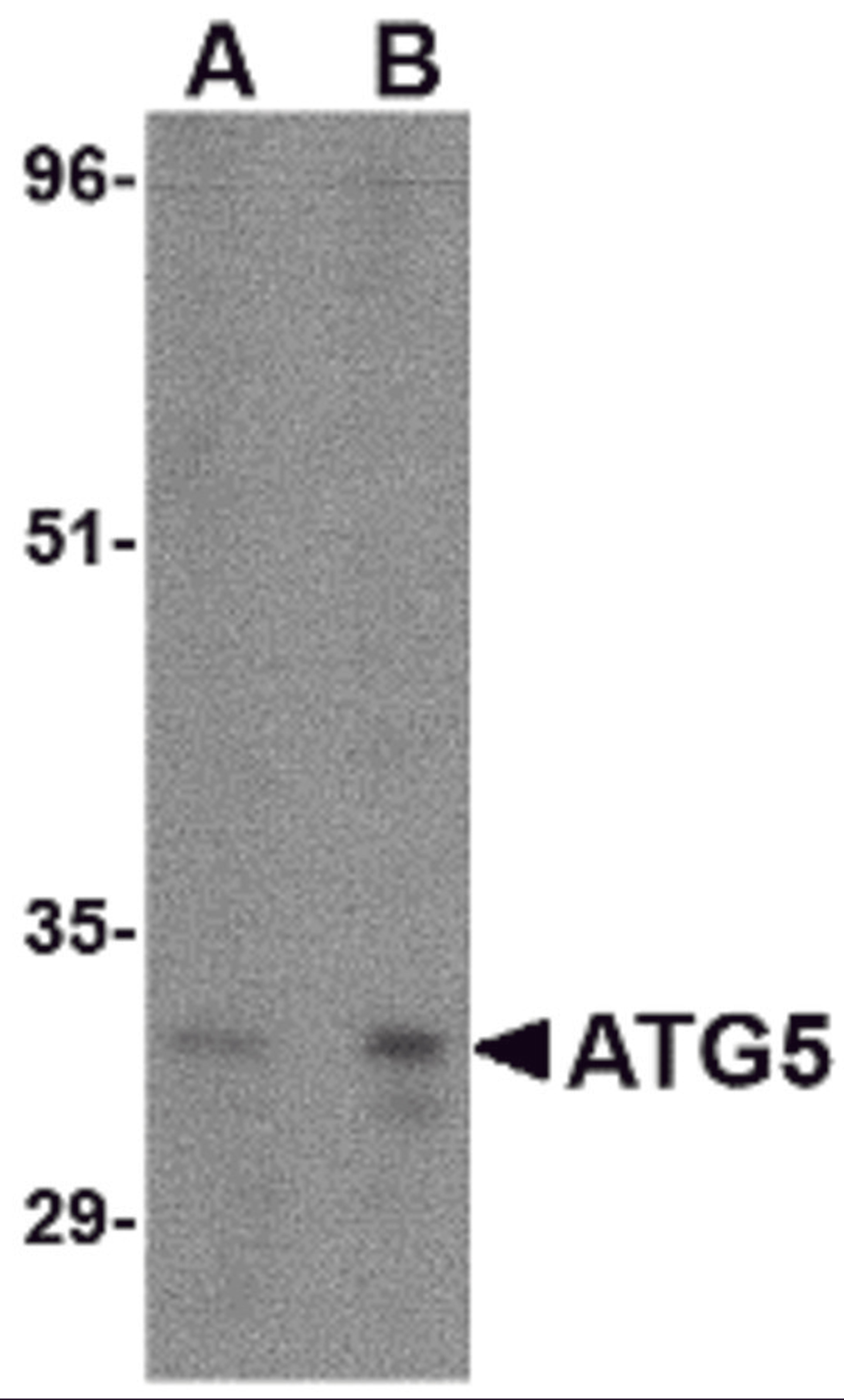 Western blot analysis of ATG5 in rat spleen tissue lysate with ATG5 antibody at (A) 1 and (B) 2 &#956;g/mL.