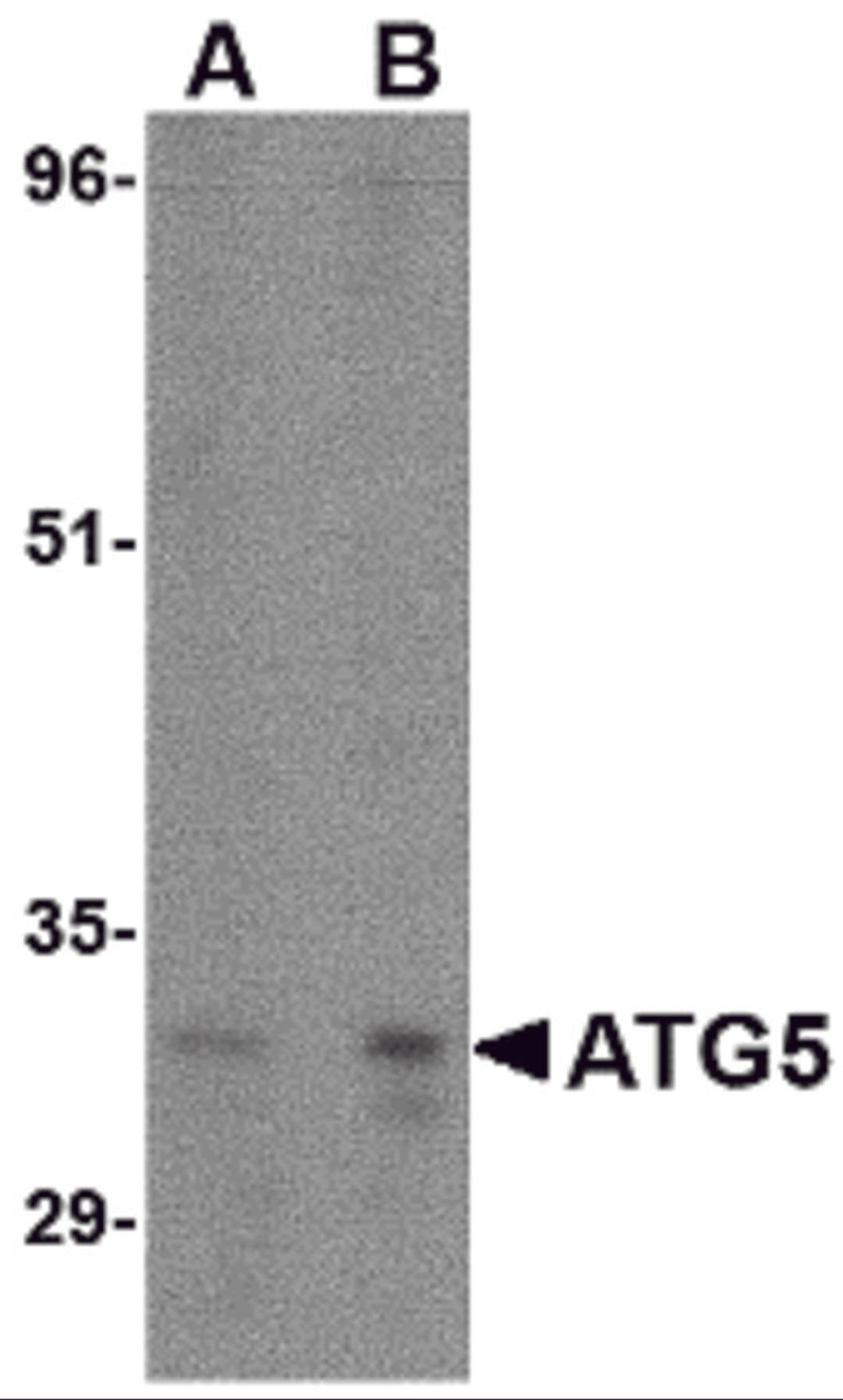 Western blot analysis of ATG5 in rat spleen tissue lysate with ATG5 antibody at (A) 1 and (B) 2 μg/mL.