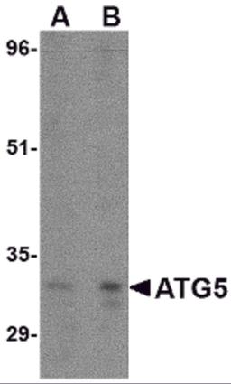 Western blot analysis of ATG5 in rat spleen tissue lysate with ATG5 antibody at (A) 1 and (B) 2 μg/mL.
