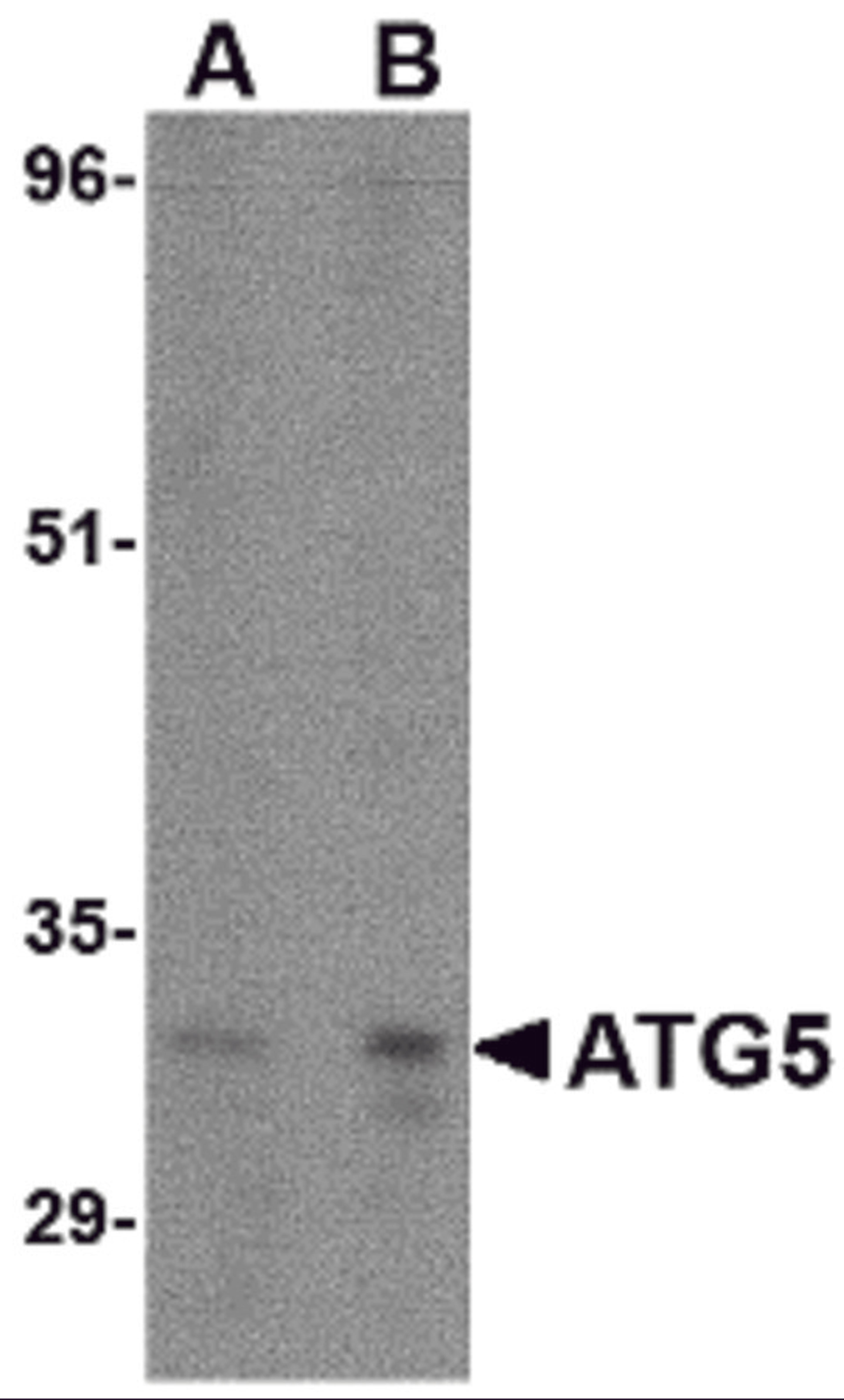 Western blot analysis of ATG5 in rat spleen tissue lysate with ATG5 antibody at (A) 1 and (B) 2 μg/mL.