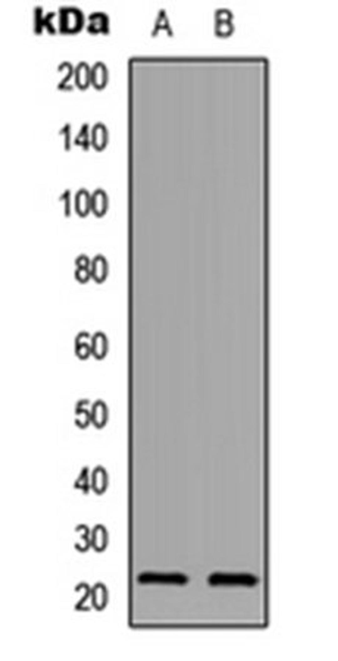 Western blot analysis of A549 (Lane 1), PC12 (Lane 2) whole cell lysates using PXMP2 antibody