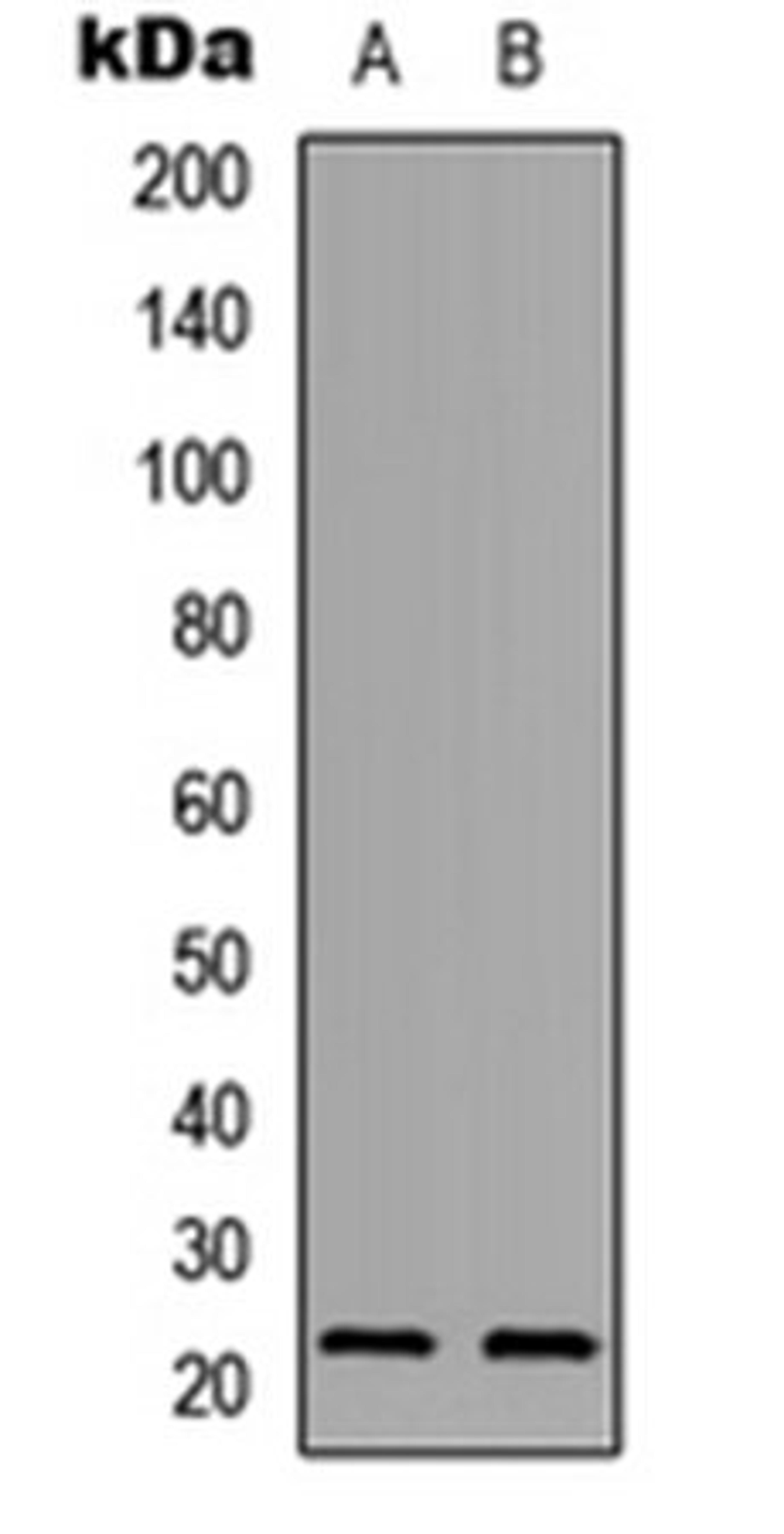 Western blot analysis of A549 (Lane 1), PC12 (Lane 2) whole cell lysates using PXMP2 antibody