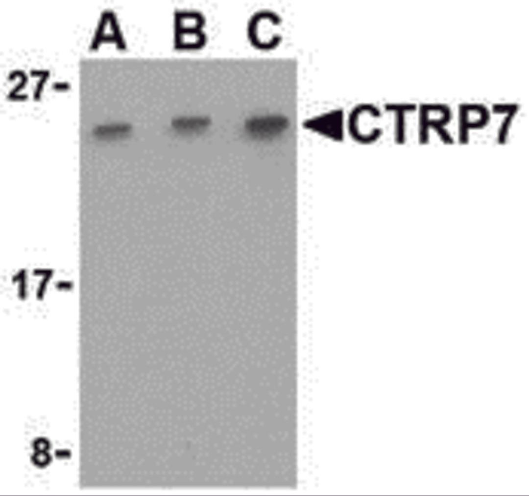 Western blot analysis of CTRP7 in 293 cell lysate with CTRP7 antibody at (A) 0.5, (B) 1, and (C) 2 μg/mL.