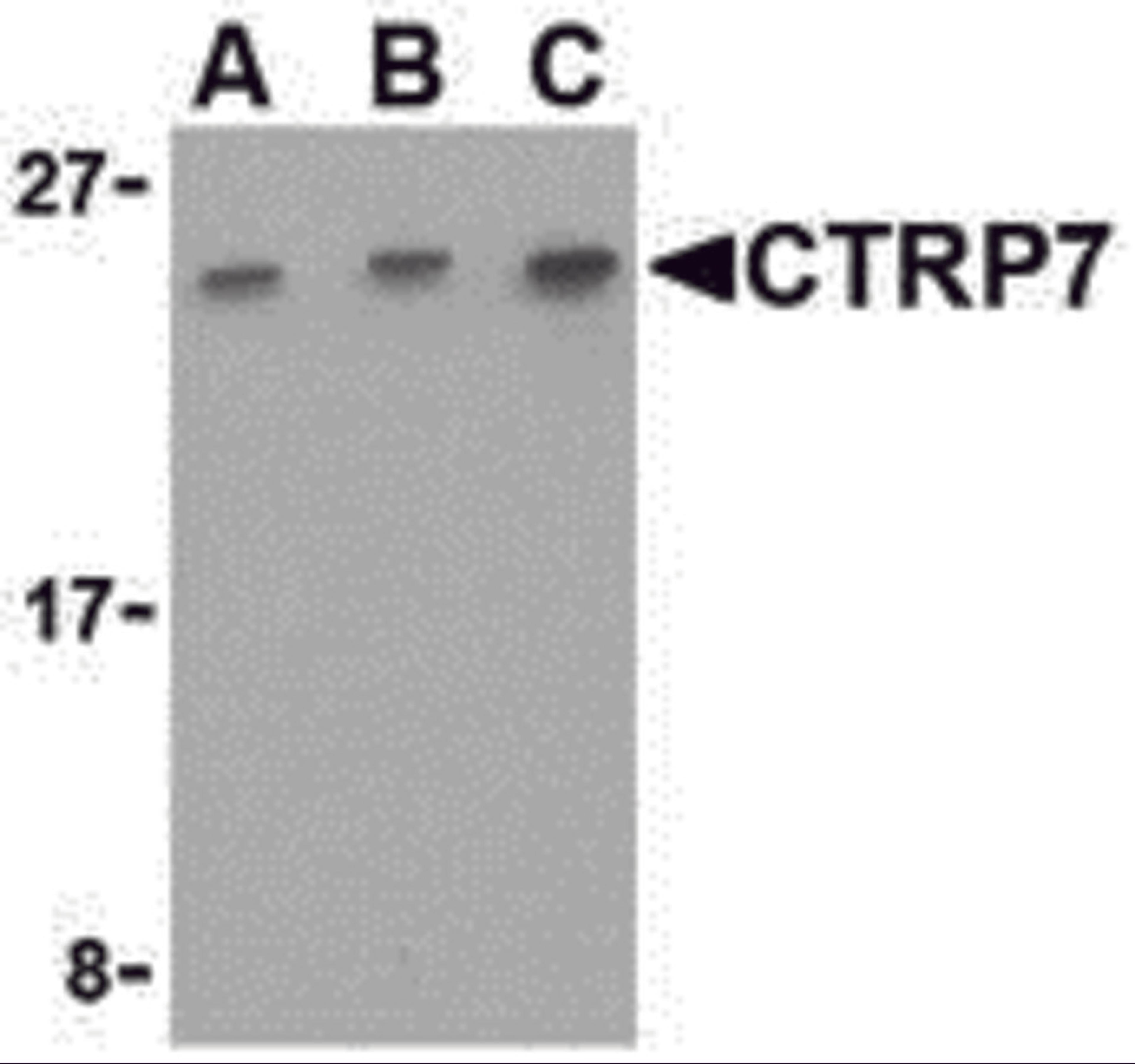 Western blot analysis of CTRP7 in 293 cell lysate with CTRP7 antibody at (A) 0.5, (B) 1, and (C) 2 μg/mL.