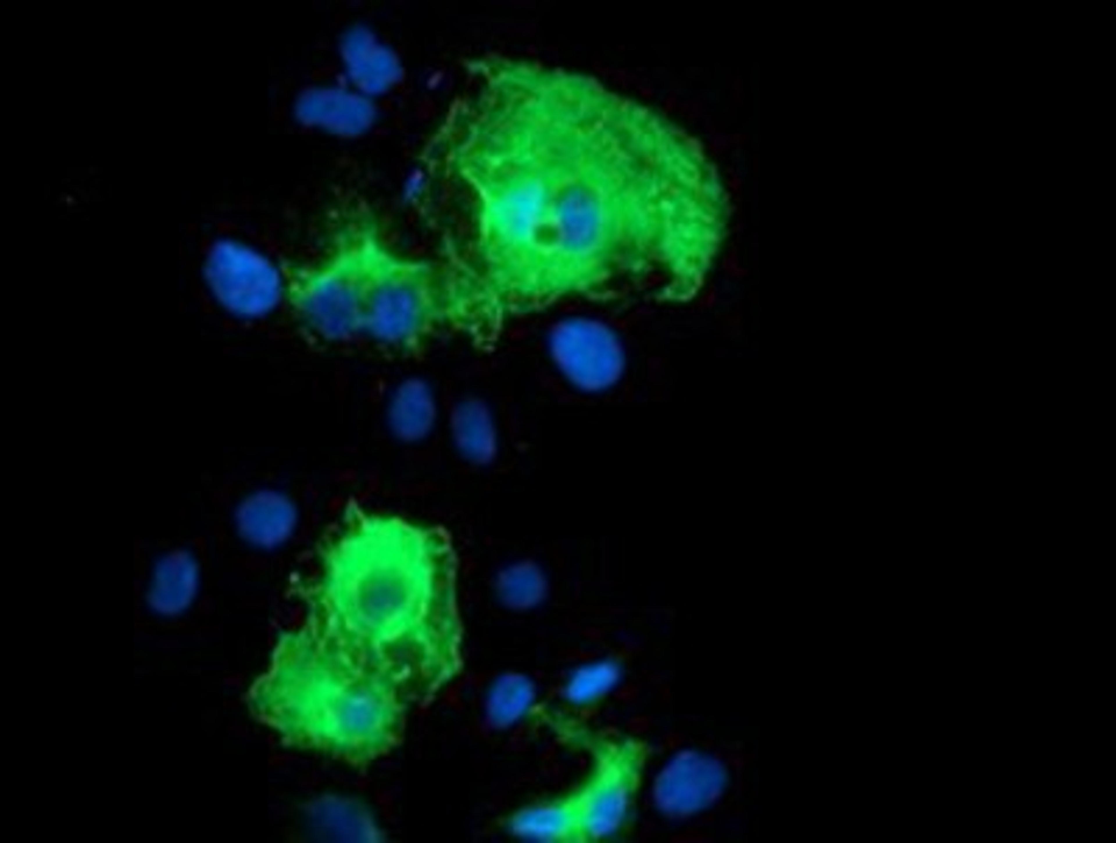 Immunocytochemistry/Immunofluorescence: SCHIP1 Antibody (1C8) [NBP2-01872] Staining of COS7 cells transiently transfected by pCMV6-ENTRY SCHIP1.